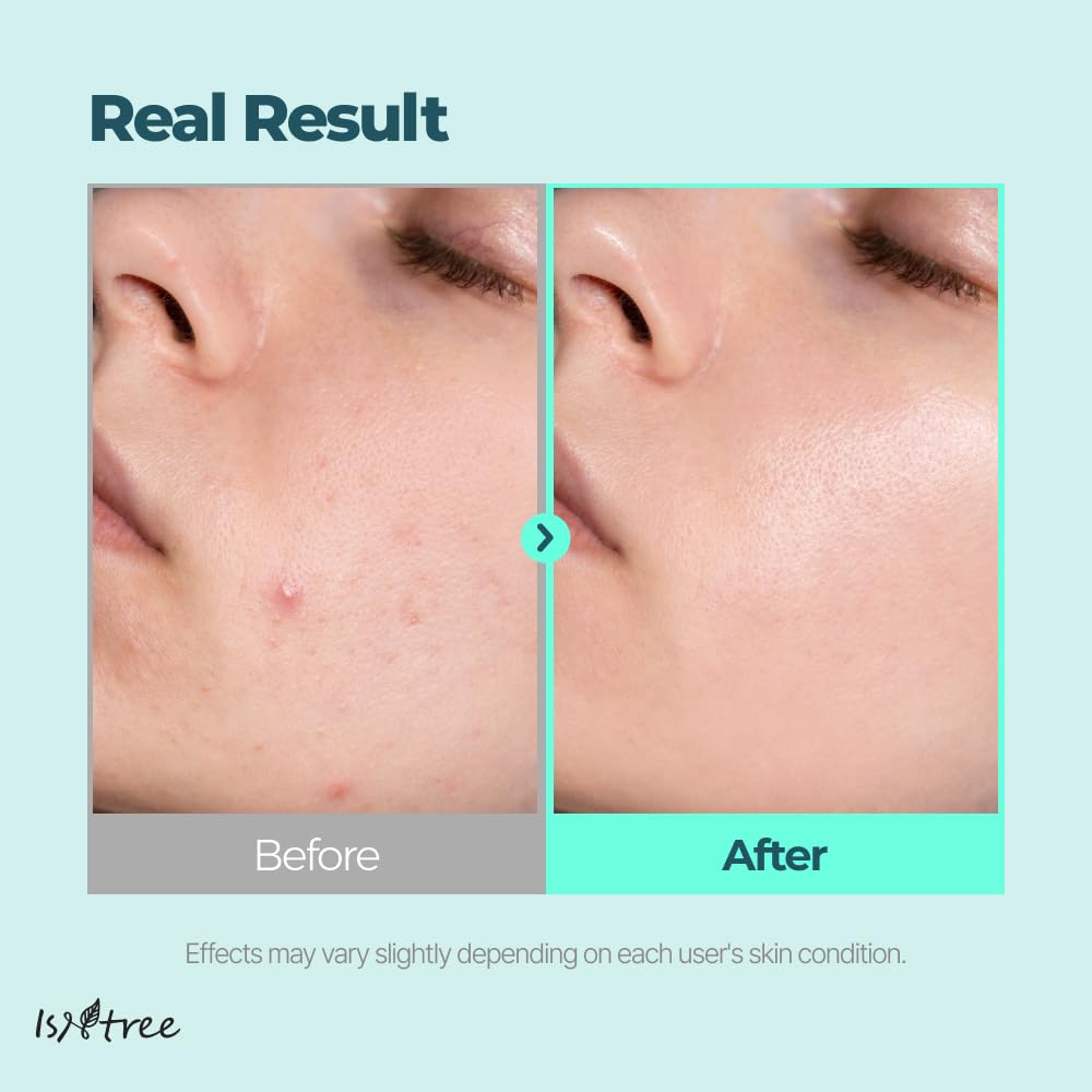 IsNtree Gim PDRN Deep Sleep Mask 80ml, 2.7 fl oz | Korean SEAWEED Skincare Sleeping Mask gel | Night Cream | Facial Mask | Overnight Gel mask for Hydration & Skin Bounce