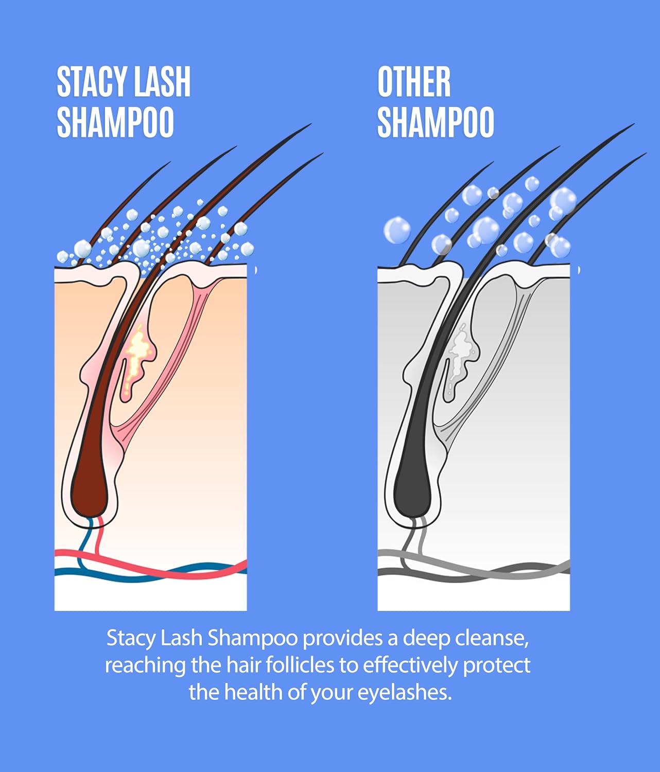 STACY LASH Lash Shampoo 100ml+ Eyelash Growth Serum Cleaning Kit of Eye Makeup Remover (Cleanser) + Brush & Eyelash Serum for Eyelash Growth and Thickness