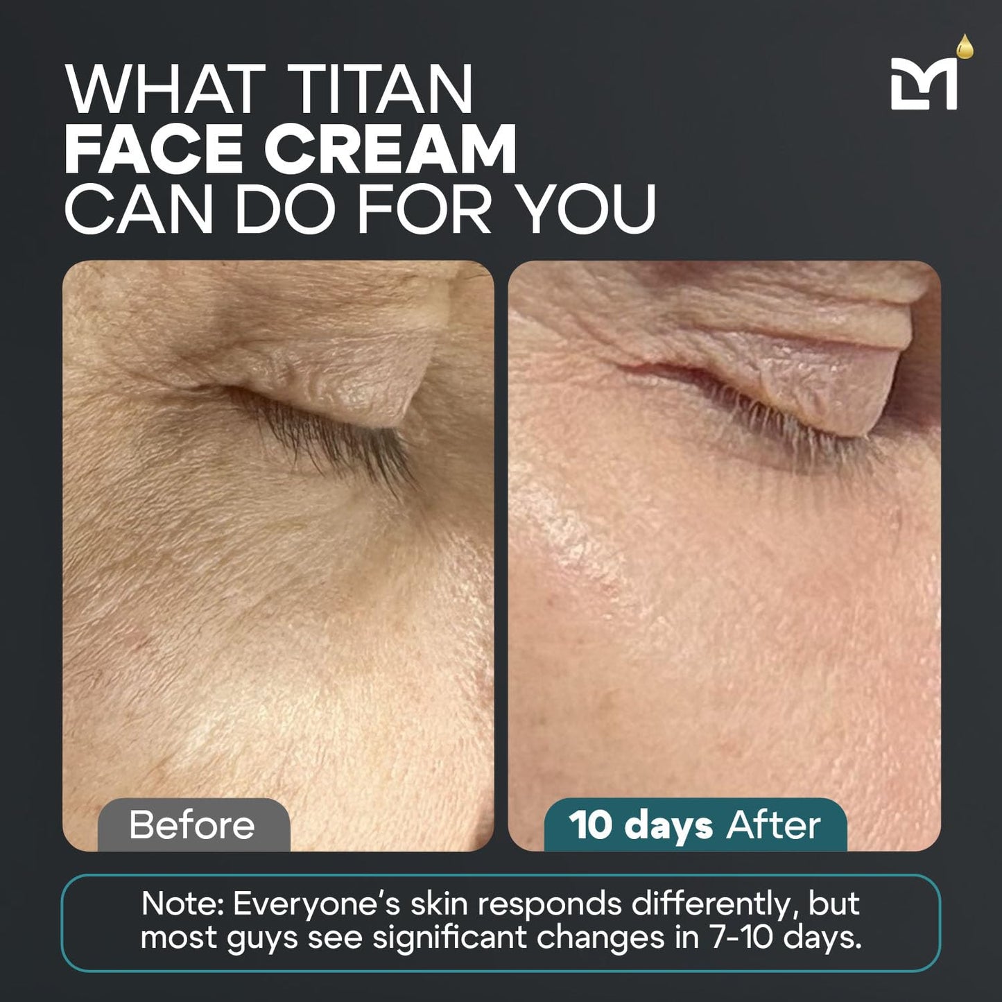 Titan Anti-Aging Mens Face Cream – Mens Face Moisturizer – For Men, Face Lotion – Men, Skin Care – Tighten, Tone, Revitalize – Ceramides, Vitamin C & E, Squalane – All Skin Types – Unscented