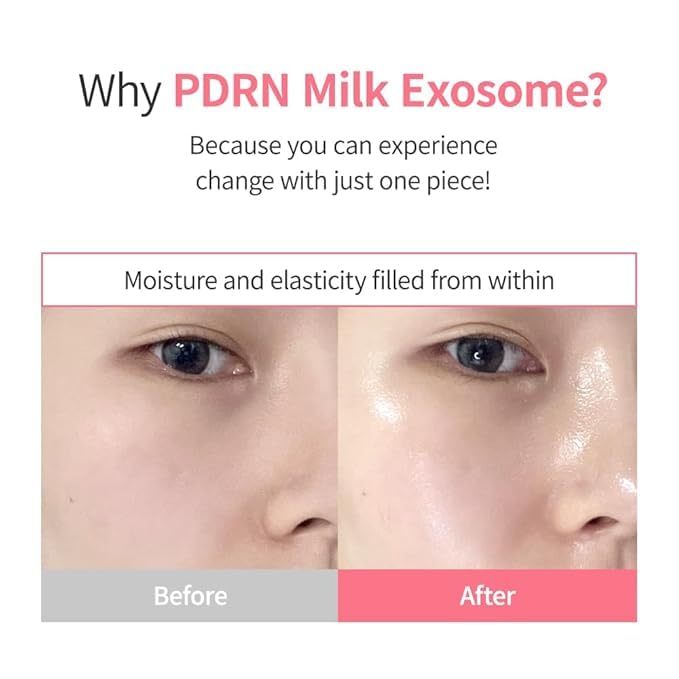 WELLDERMA PDRN Exosome Hydrogel Fitting Mask, 30g x 4 Sheets – Revitalizing & Hydrating Micro-Hole Sheet Mask with PDRN (Sodium DNA), Milk Exosome, Peptides & Hyaluronic Complex