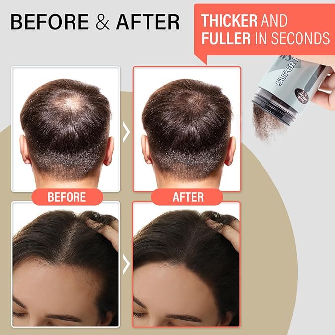 SMH Hair Fibers MADE IN JAPAN – Instantly Conceals Thinning Hair –Long-Lasting – Sweat, Water & Wind Resistant – Hair Loss Solutions For Men & Women (White, 15g)