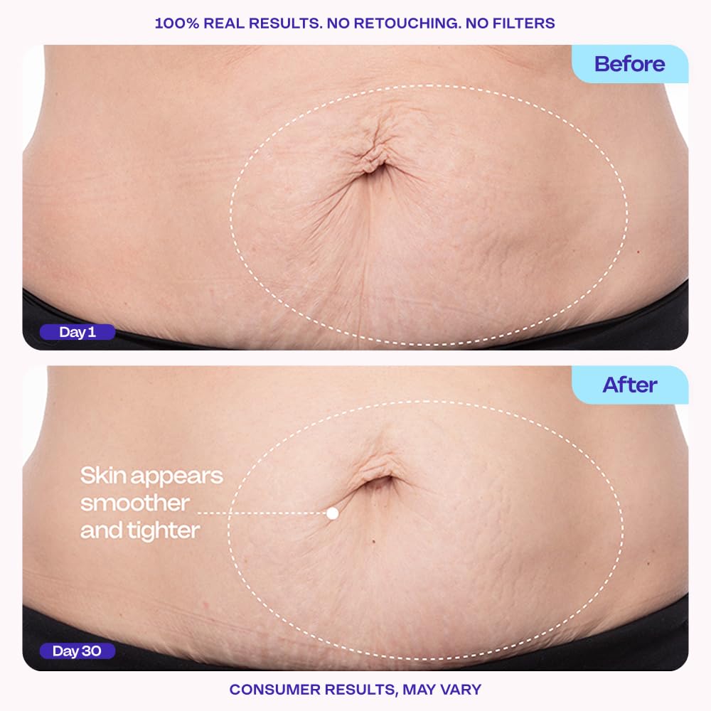 goPure Tighten & Smooth Belly Cream - Clinically Tested