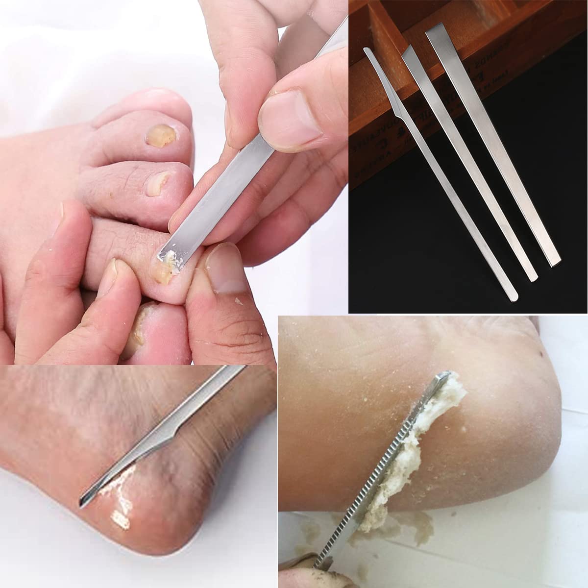 Stainless steel ingrown toenail pedicure knife set,professional foot skin scraper repair sharp blade kit for nail corn callus paronychia treatment. (3)