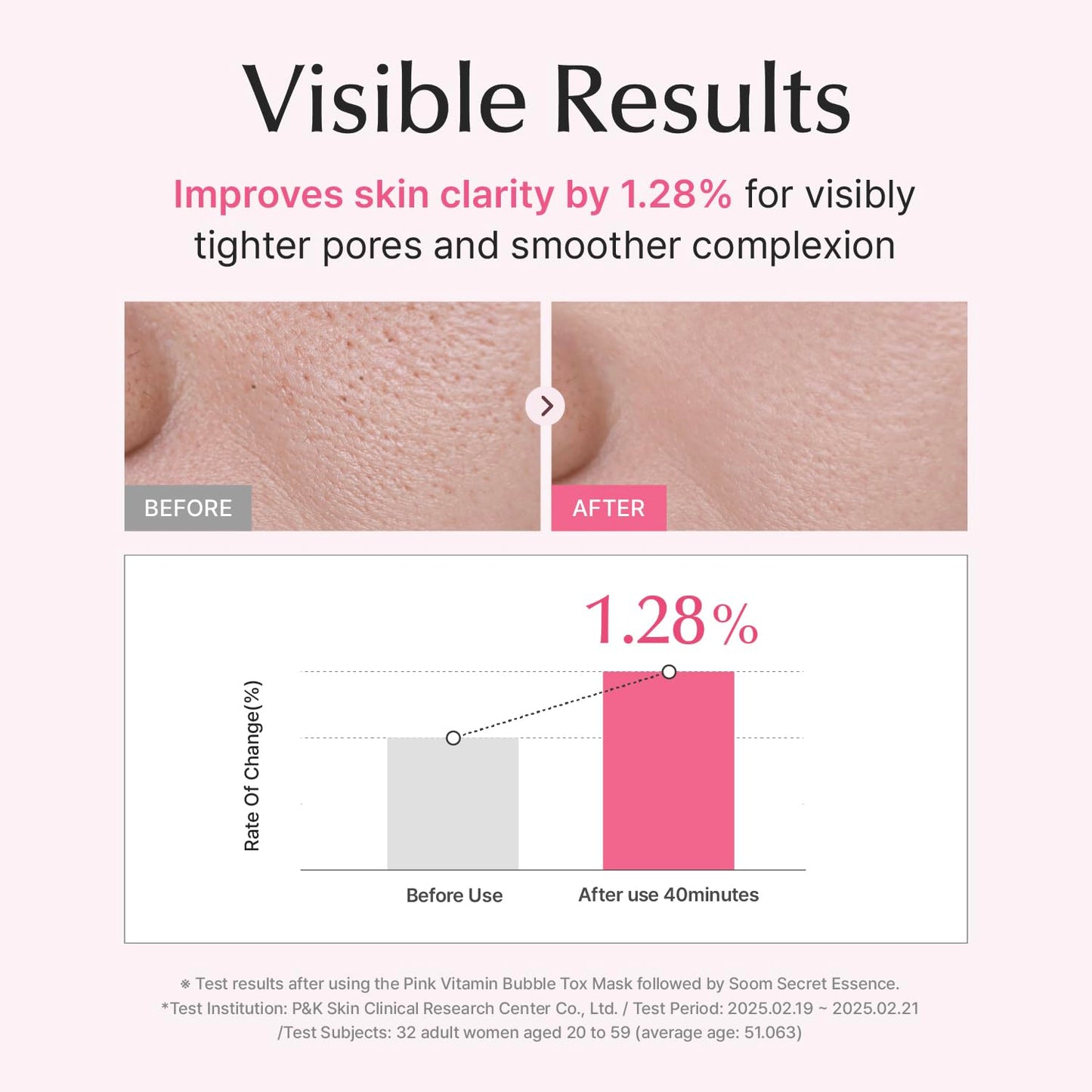 SU:M Micro-Active Pink Vitamin Bubbletox Mask Pack (0.13 fl oz x 14ea) - Korean Skincare – Deep pore cleansing, hydration with Fermented Pink Vitamin 12, Hibiscus, Kaolin & Bentonite