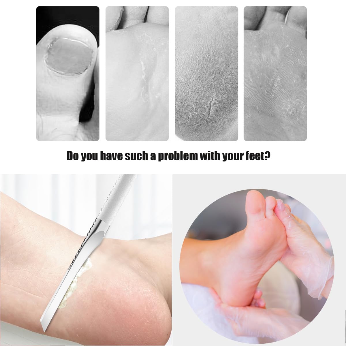 Stainless steel ingrown toenail pedicure knife set,professional foot skin scraper repair sharp blade kit for nail corn callus paronychia treatment. (3)