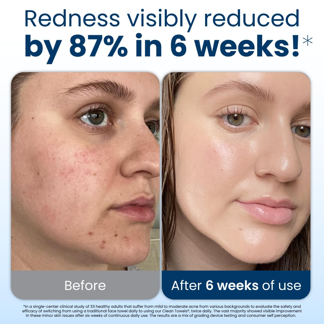 Clean Skin Club Clean Towels XL®, 100% USDA Biobased Face Towel, Disposable Face Towelette, Eczema Association Accepted, Makeup Remover Dry Wipes, Ultra Soft, 1 Pack, 50 Ct