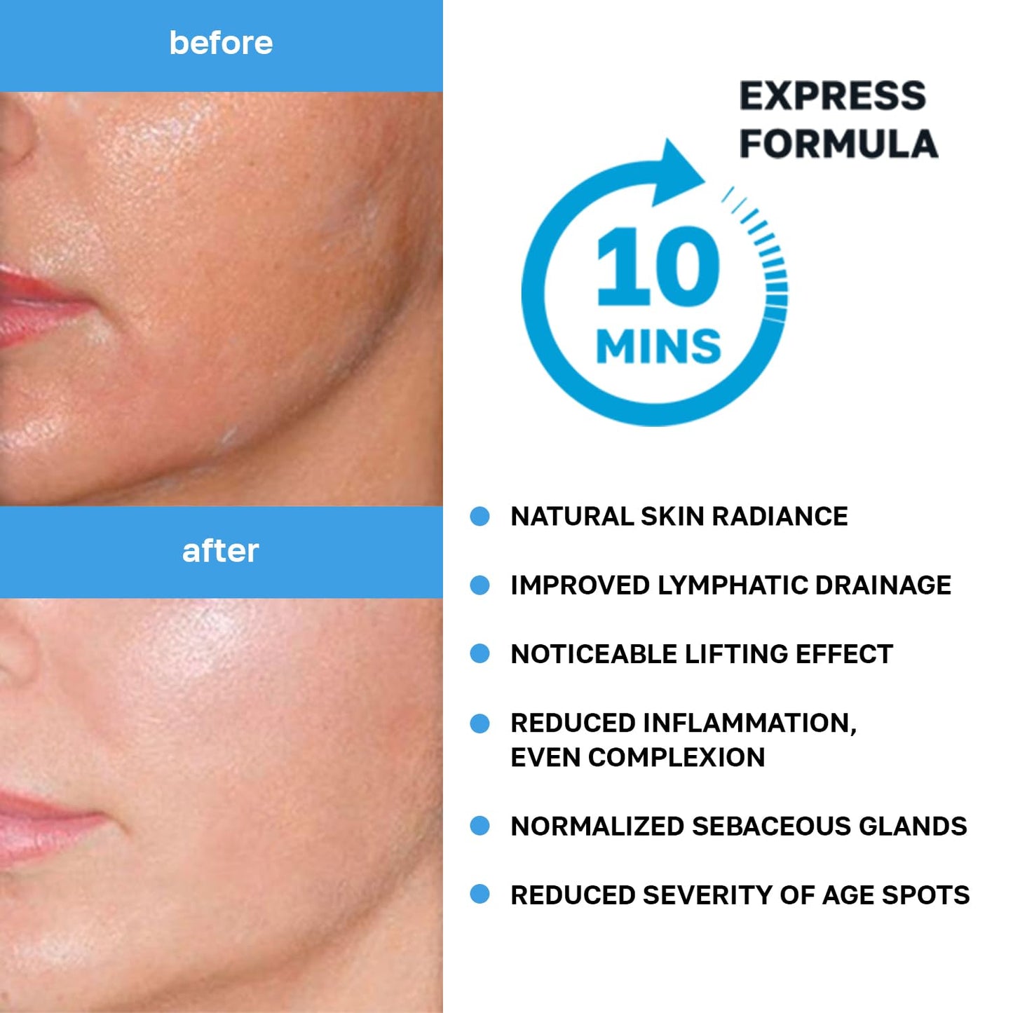 Name Skin Care Korean Carboxy CO2 Therapy Face & Neck Mask Set of 2 - Hydrating Oxygen Carboxytherapy Skincare Sheet Masks - Moisturizing Anti Aging Pore Tightening Brightening Facial Treatment Gel