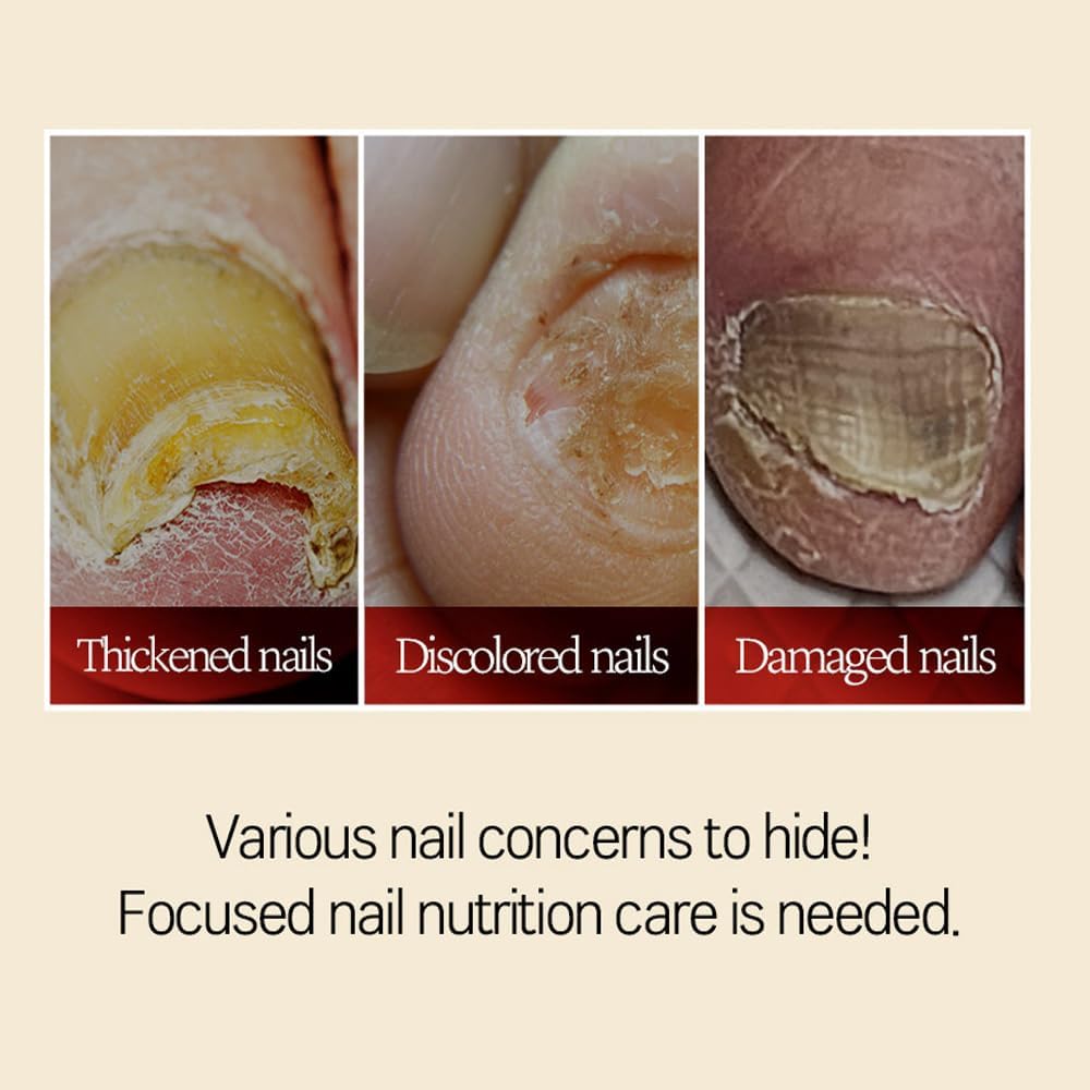 Safepick Miracle Nail Serum Nail Strengthener | Clear & Opaque Crème Nail Polish Treatment | Strengthen Weak & Thin Nails