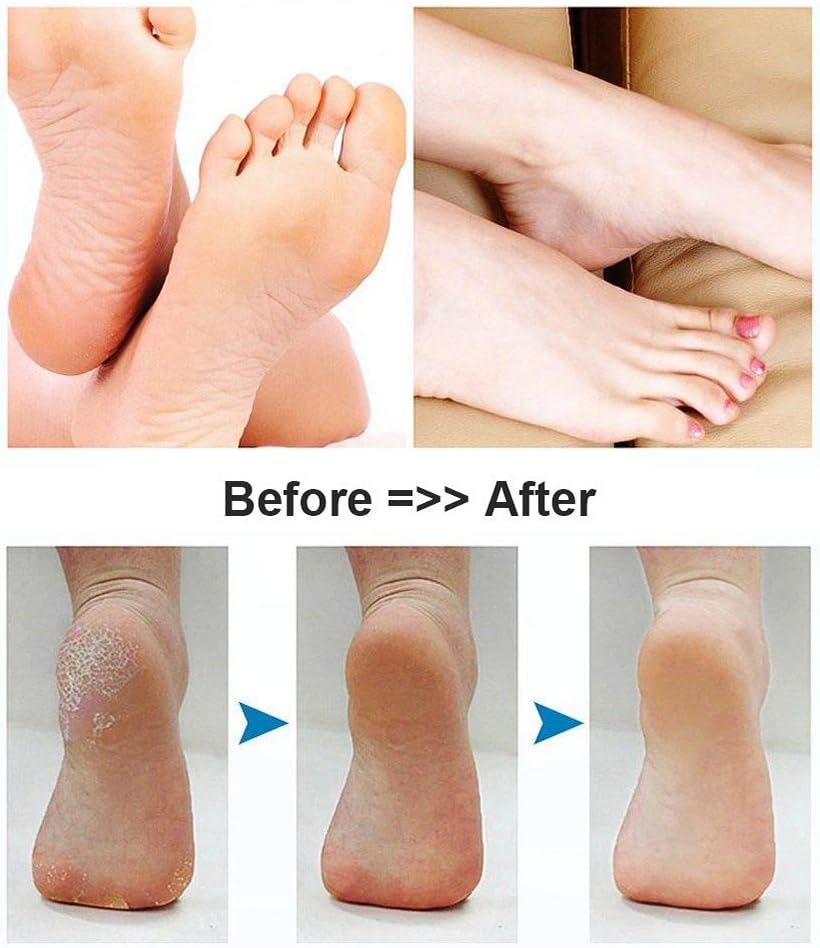 BOMPOW Foot Scrubber Electric Callus Remover Rechargeable Foot File Hard Skin Remover Pedicure Tools Electronic Callus kit for Cracked Heels and Dead Skin with 2 Roller Heads