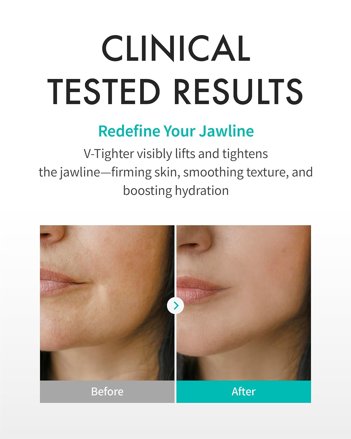 REJURAN® Perfect V Tighter Dual-Sheet Lifting Sheet Mask, c-PDRN® (4ea) – Face & Jawline Lifting and Firming Original PDRN & Purecolla, Deep Moisturizing, Skin Tightening Anti-Aging Korean Skin Care