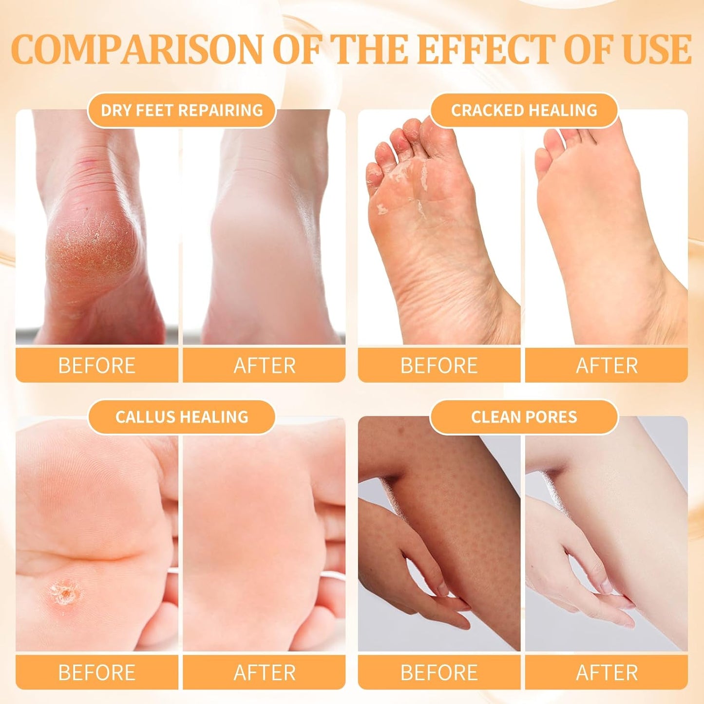 Pedicure Kit Foot Soak Set: Bubble Salt, Sugar Scrub, Massage Mask, Massage Lotion in a Box, 4 Step Foot Spa Kit for Dry Feet,Tired Feet（3 Set Tropical Fruit)