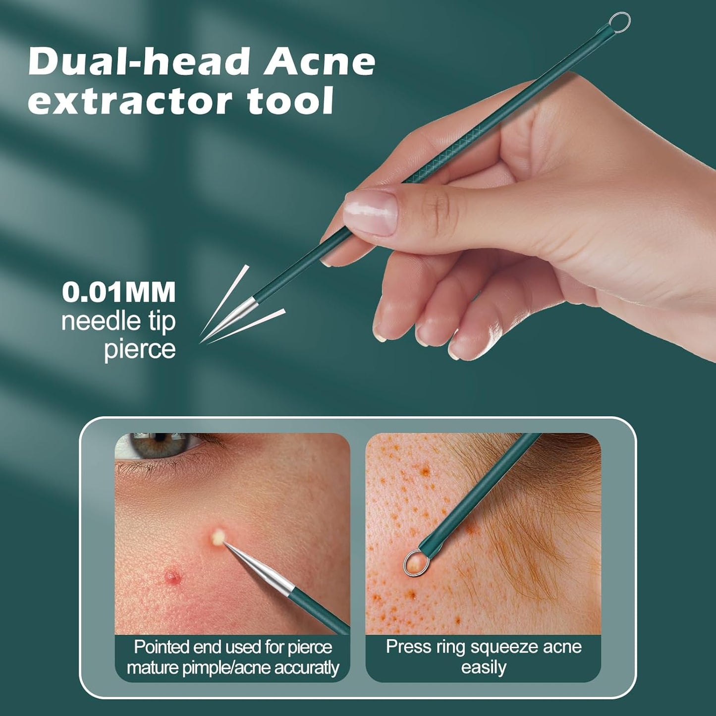 WSYUB Upgrade Professional Facial Blackhead Remover Tweezers, Ingrown Hair Tweezers,Extractor Acne Removal, Pimple Popper Tool,Green