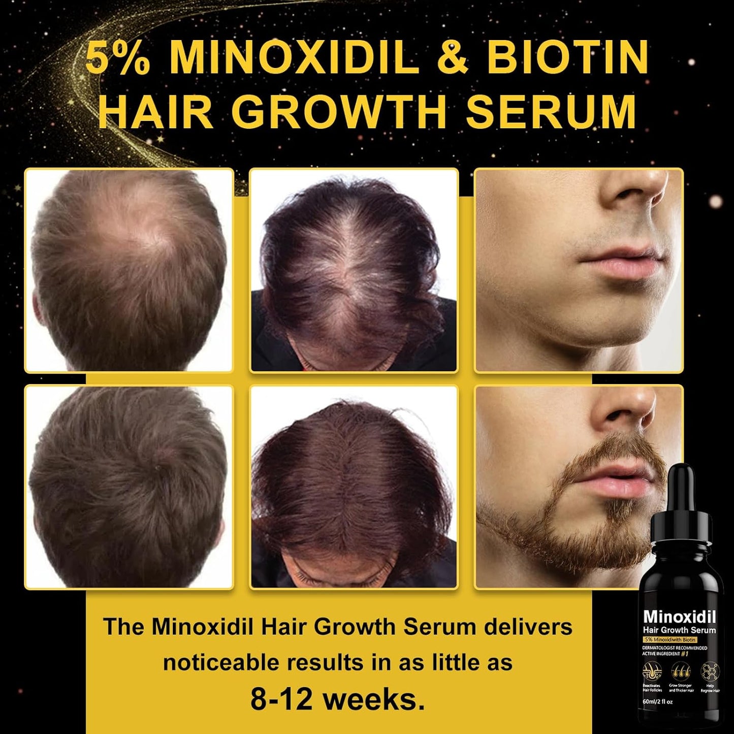 5% Minoxidil Hair Growth Serum, Topical Minoxidil for Men Beard Growth, Hair Regrowth for WomenTreatment for Scalp Hair Loss and Thinning, With Biotin