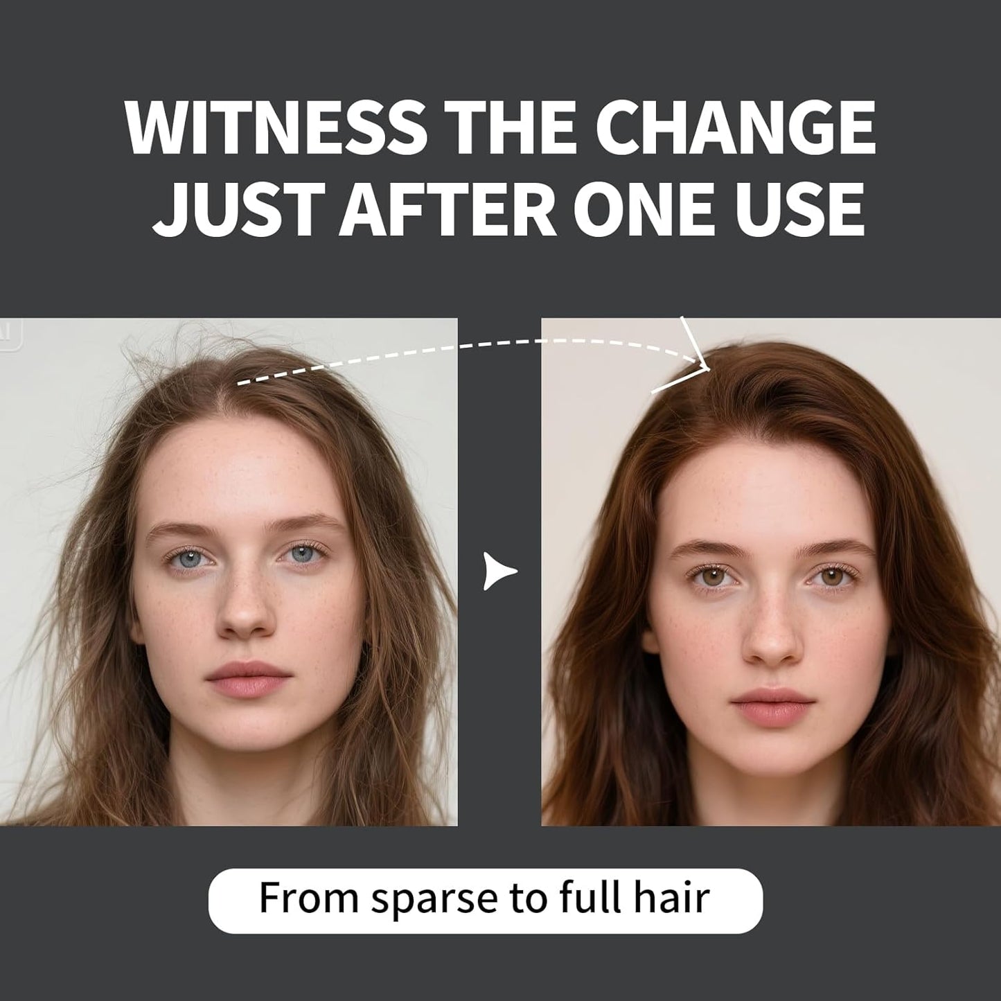 Hair Building Fibers Refill Pack - 100g Instant Thickening Fibers for Men & Women, Natural Cotton Powder, Wind/Rain Resistant, For All Hair Fiber Applicator Bottles (Black)