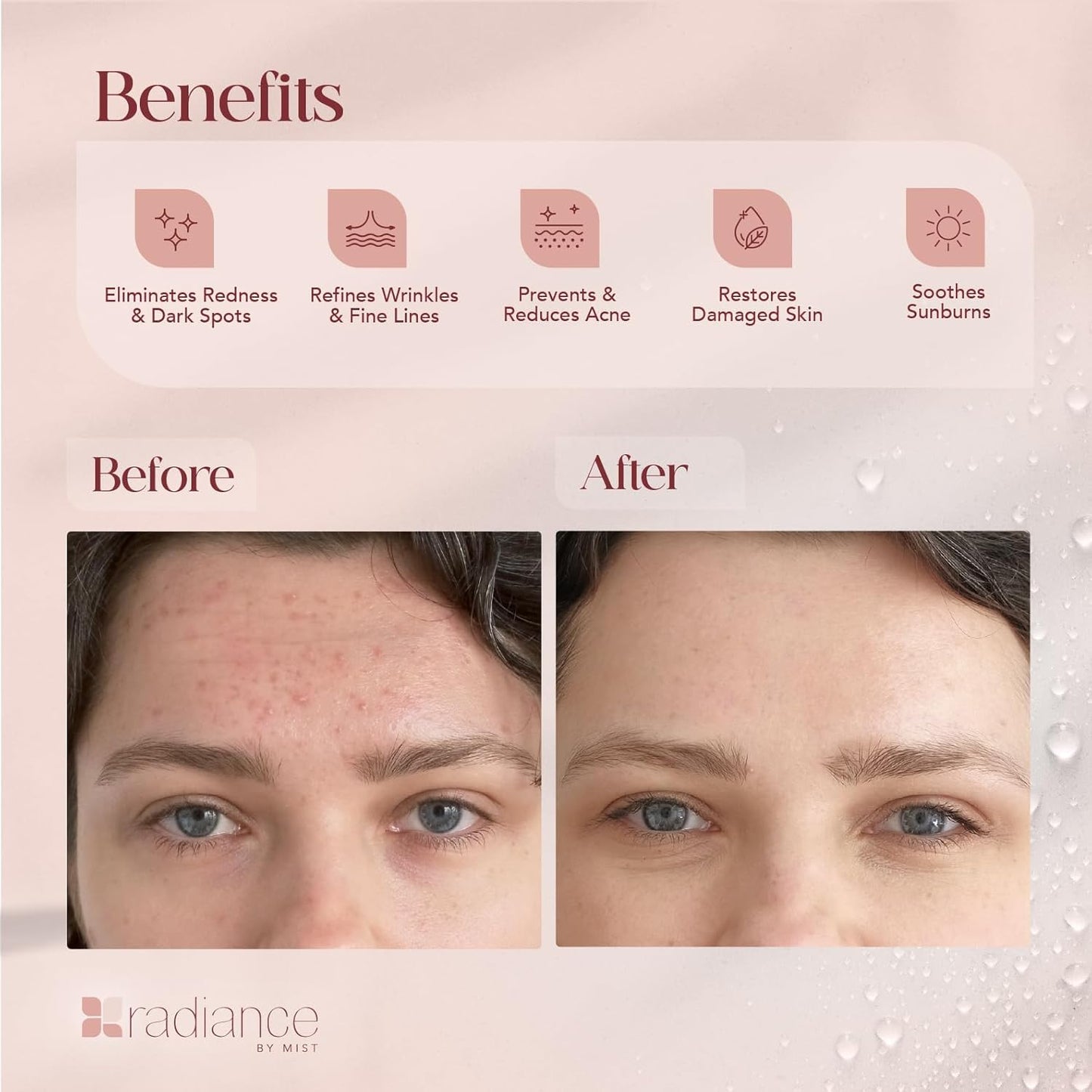 Radiance Snail Mucin Serum with Advanced Snail 96% Mucin Power Essence, Korean Skin Care with Hydrating Hyalauronic Acid Korean Serum, 3.38 fl oz, 100ml