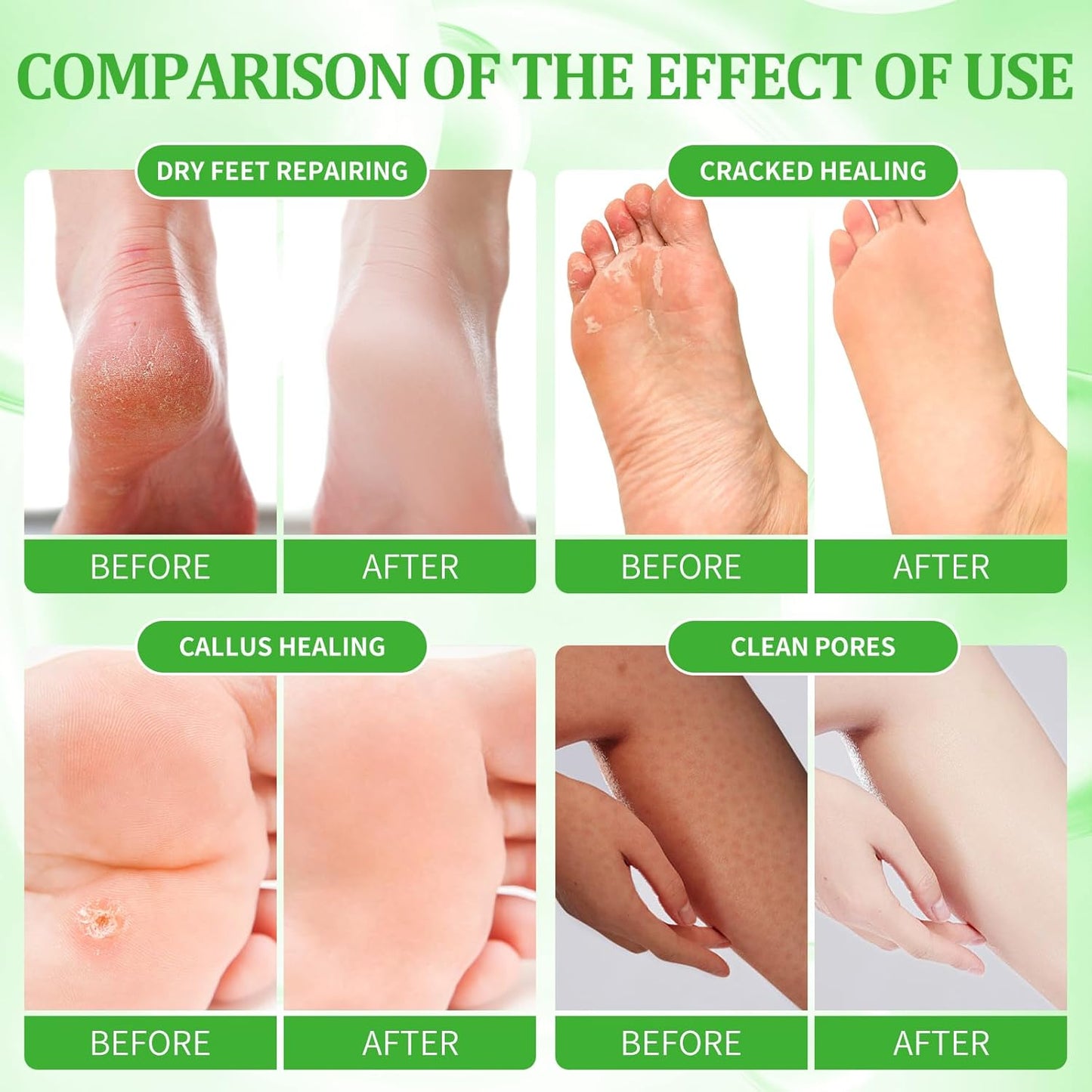 Pedicure Kit Foot Soak Set: Bubble Salt, Sugar Scrub, Massage Mask, Massage Lotion in a Box, 4 Step Foot Spa Kit for Dry Feet, Calluses and Tired Feet(1 Set Peppermint)