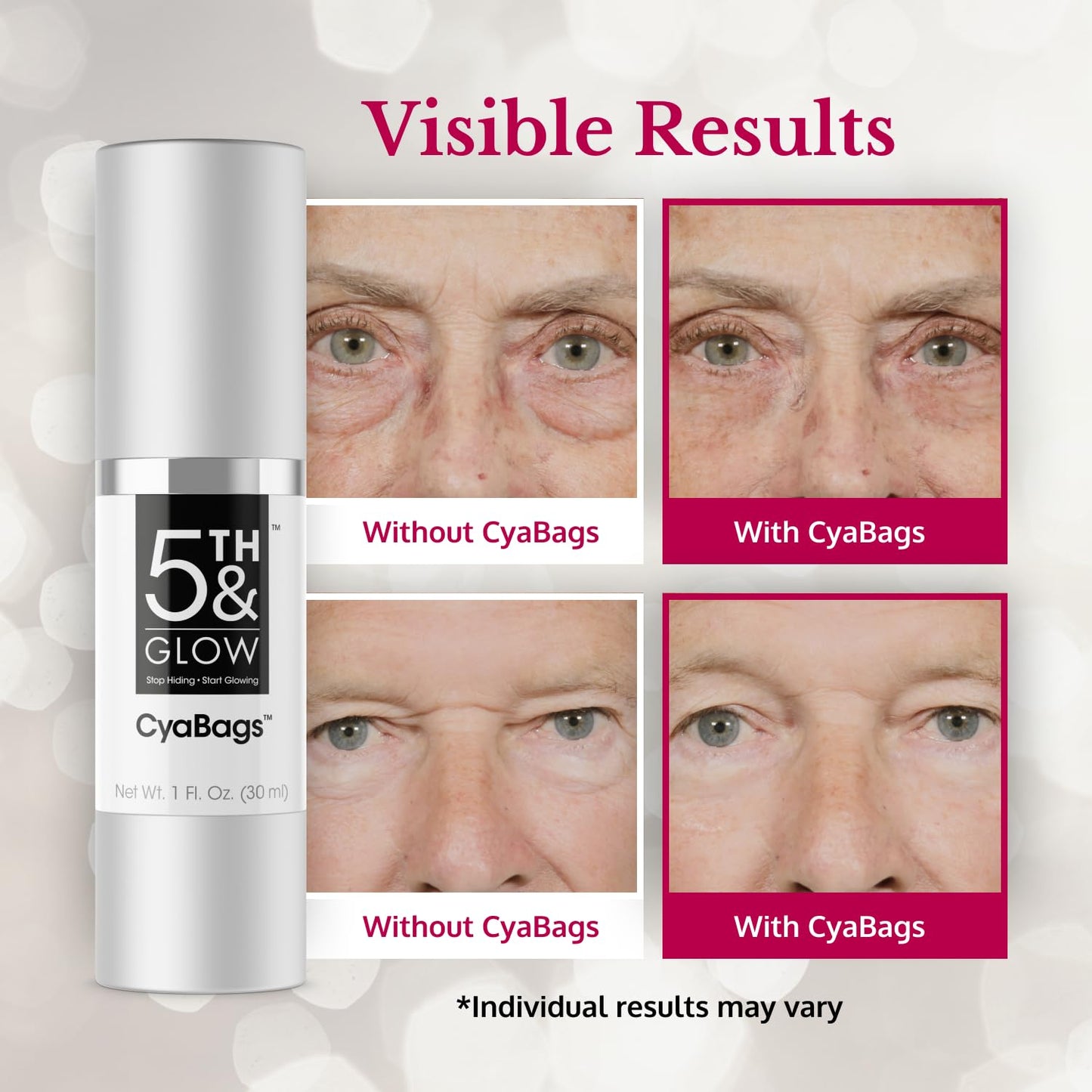 5th & Glow Cyabags - Instant Under Eye Bag Remover Serum For Dark Circles & Puffy Eyes Reduction - Hyaluronic Acid & Vitamin C Cream for Fine Lines, Wrinkles & Crowsfeet, 1 oz