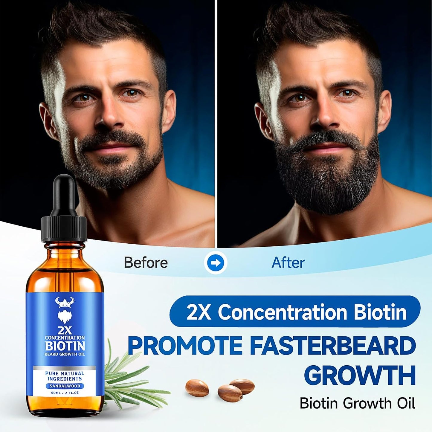 Beard Growth Oil - 2X Concentration Biotin Beard Oil for Men (2 oz) - Natural Mens Beard Oil with Argan Oil, Jojoba Oil and Vitamin, Beard Growth Softener, Moisturizer (Sandalwood)