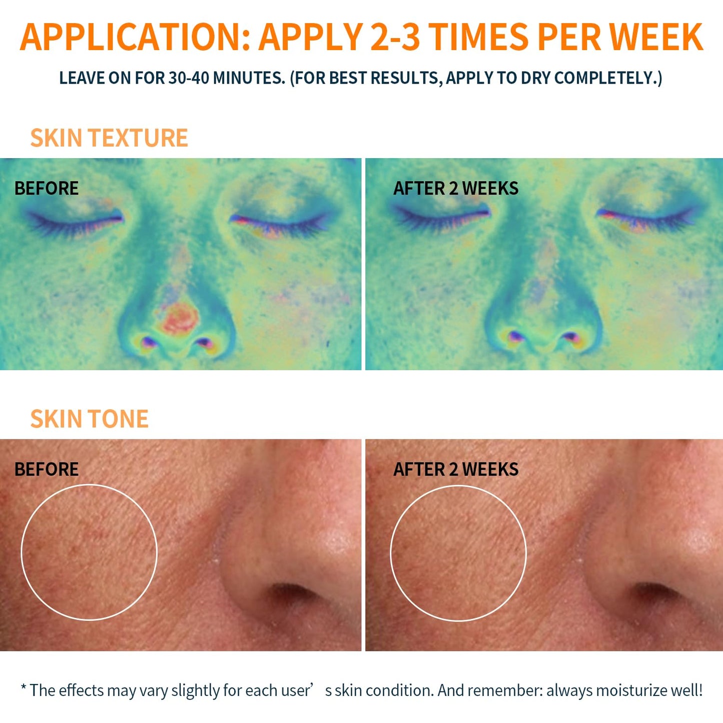 Firming and Moisturizing Sheet Face Masks (Pack of 10) with Hyaluronic Acid and Peptides, Reduce Fine Lines and Wrinkles, Hydrating & Anti-Aging Spa Face Mask, Facial Skin Care