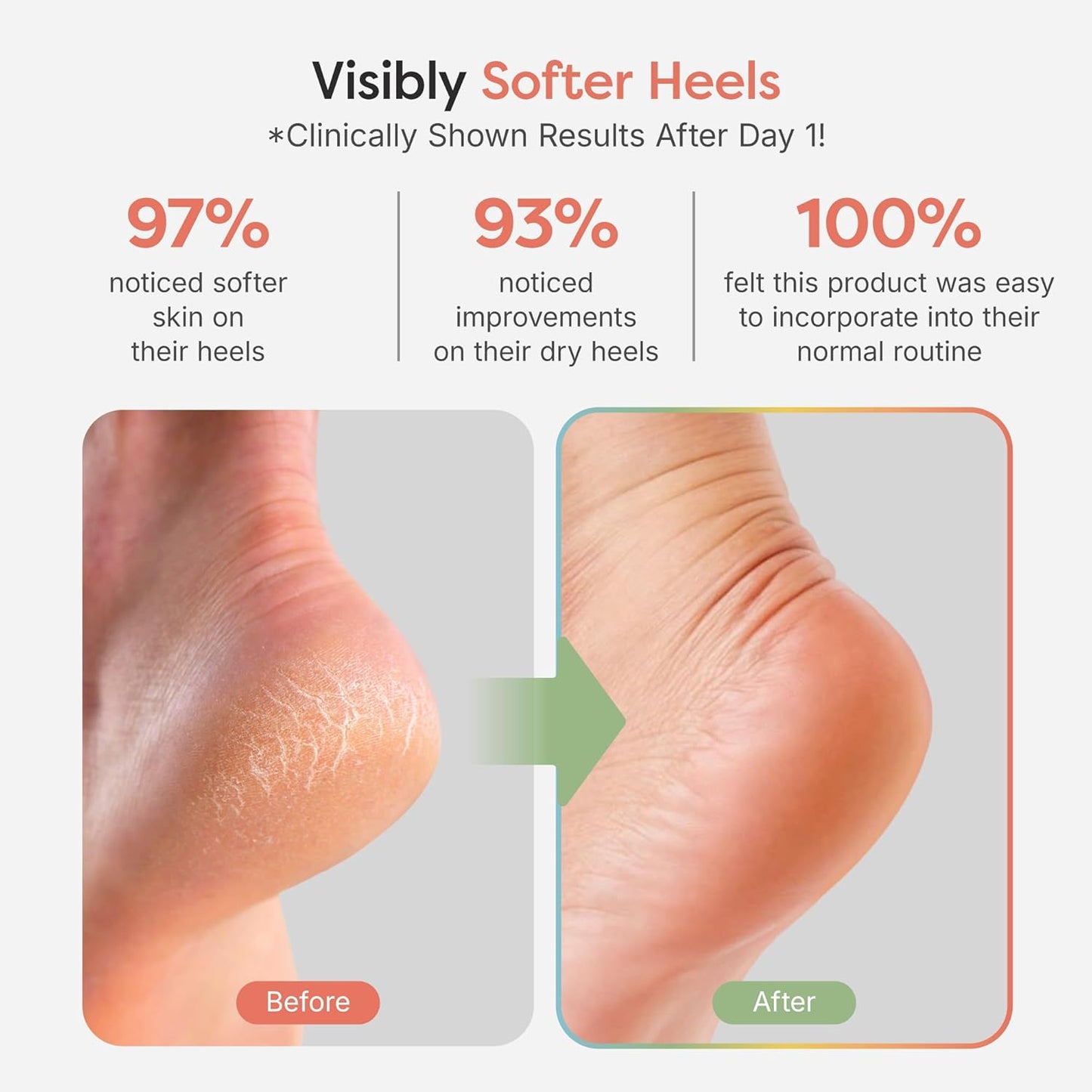 ZenToes Moisturizing Socks for Cracked Heel Treatment - Vitamin E, Olive Oil and Jojoba Oil Infused Heel Socks to Soften and Hydrate (Fuzzy Black, Regular)