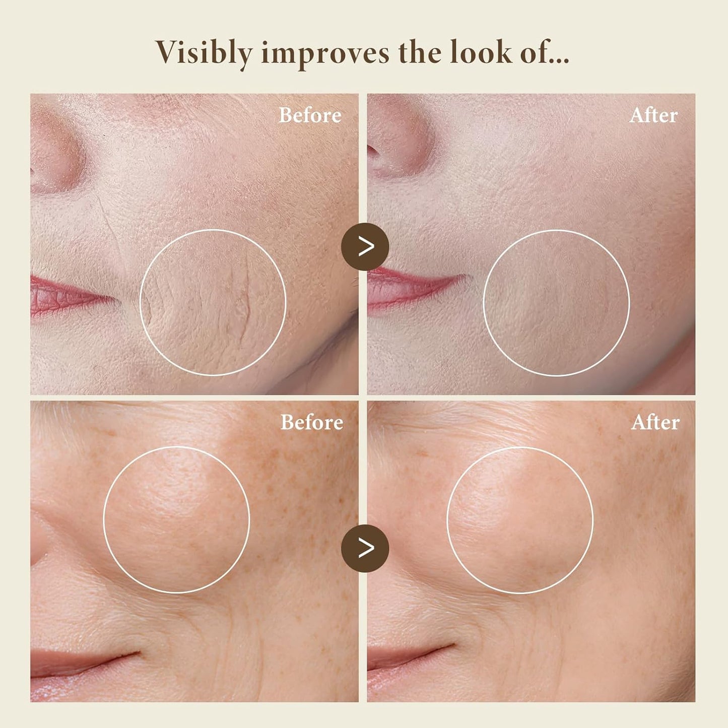 BIOCHEM Golden Placenta Ultra Essence - Placenta Face Serum with Gold Foil, Anti-aging, Hydrating, Firming, Wrinkles, Fine Lines and Skin Tone, Gentle Skincare for Fragrance-Free(4.06 fl. oz / 120 mL)