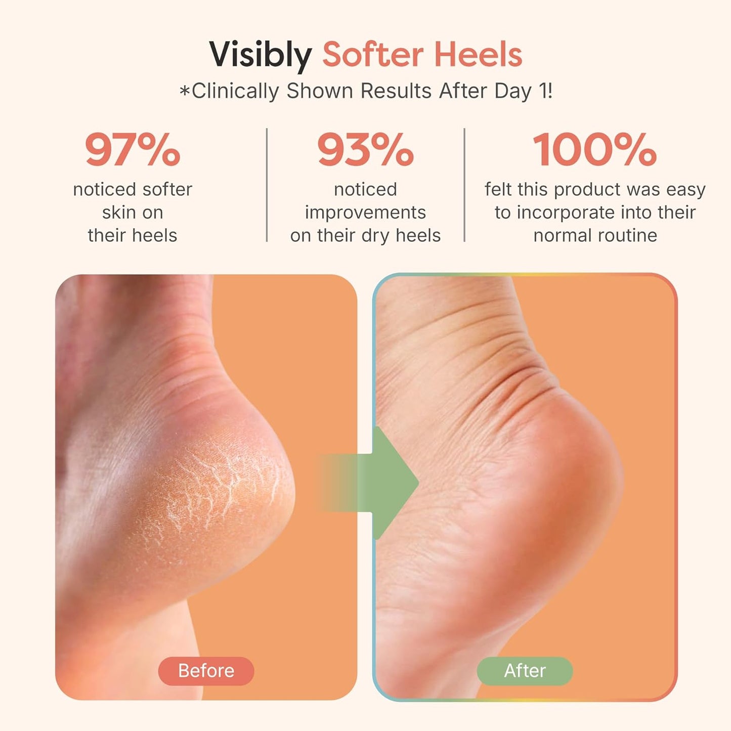 ZenToes Moisturizing Fuzzy Sleep Socks with Vitamin E, Olive Oil and Jojoba Seed Oil to Soften and Hydrate Dry Cracked Heels (Regular, Blue and Pink)
