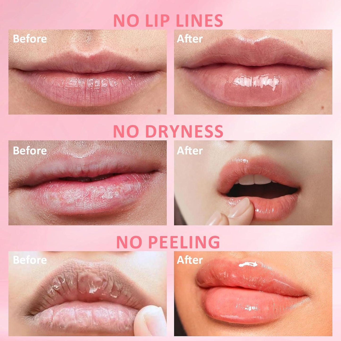 DMSKY Bee Lip Balm Honey Pot 6 PCS, Nourish & Hydrate Lip Sleeping Mask with Vitamin E, Lip Mask Overnight for Dry Lips, Reduces Lip Lines