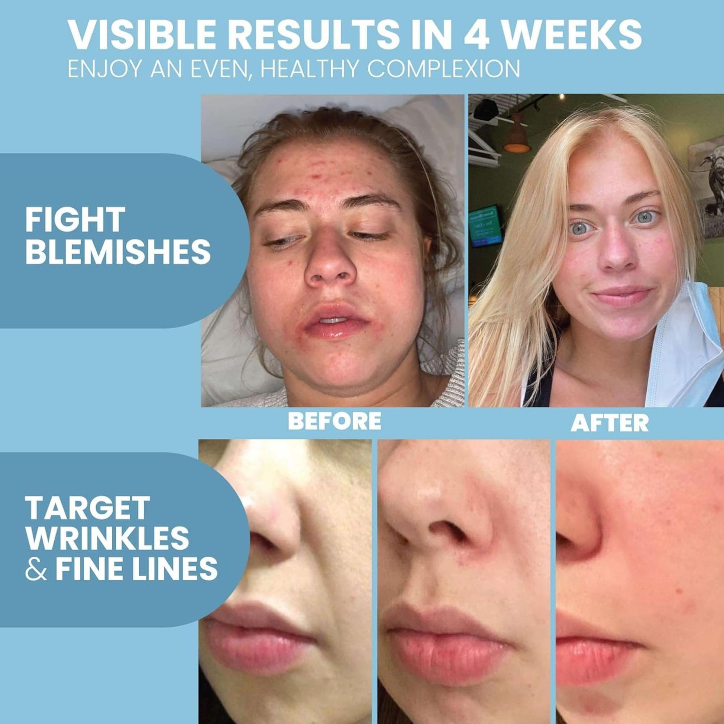 Eva Naturals Retinol Serum for Face – Anti Aging Night Serum with Hyaluronic Acid, Vitamin E, Witch Hazel, Aloe – Wrinkle Moisturizer, Dark Spot Corrector, Acne Scar Treatment, Skin Brightening – 2oz