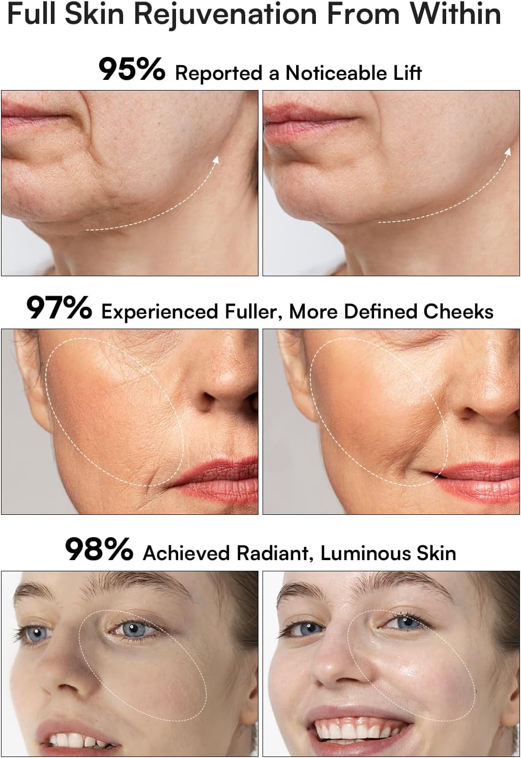 INIA 3-in-1 Red Light Therapy for Face and Neck Beauty Device for Puffiness & Skin Firming Skincare Tool