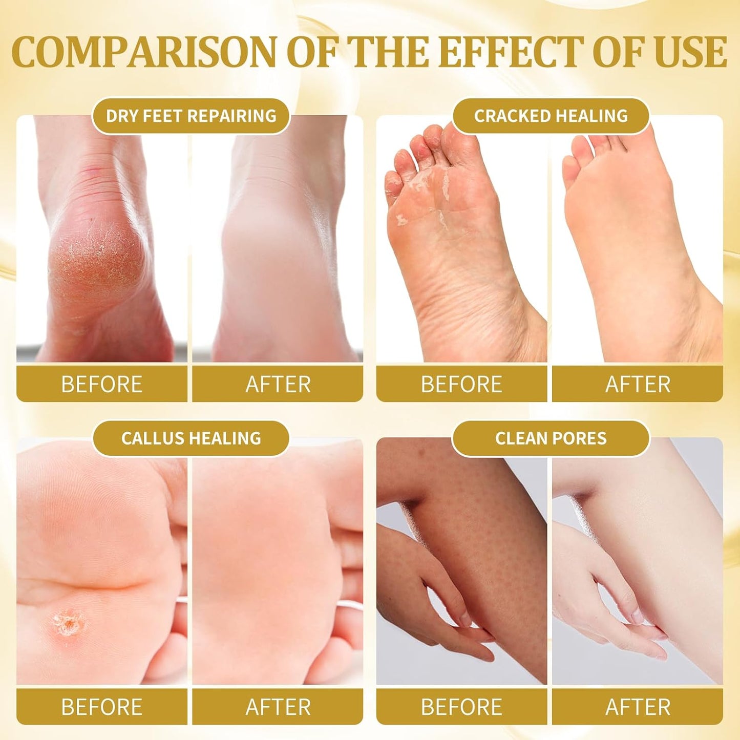 Pedicure Kit Foot Soak Set: Bubble Salt, Sugar Scrub, Massage Mask, Massage Lotion in a Box, 4 Step Foot Spa Kit for Dry Feet, Calluses and Tired Feet(1 Set Honey Flower)