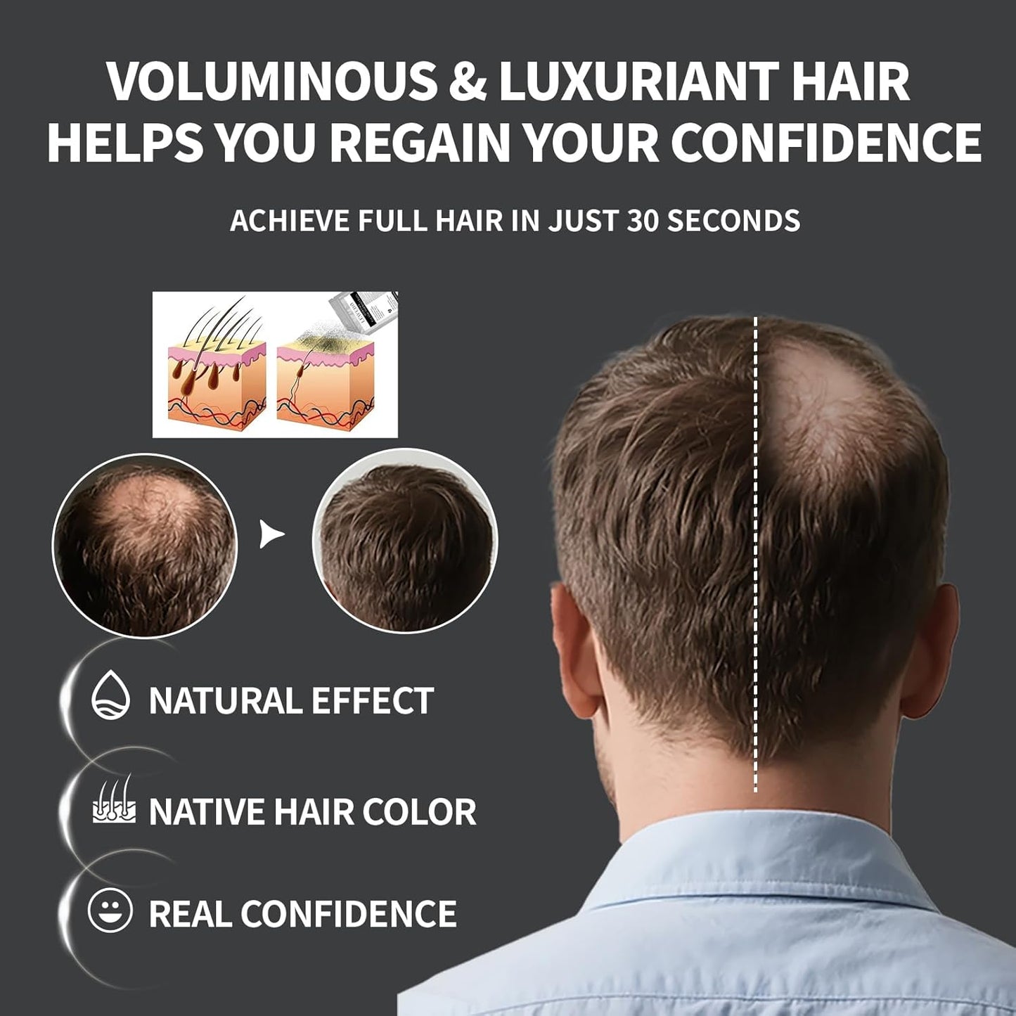 Hair Building Fibers Refill Pack - 100g Instant Thickening Fibers for Men & Women, Natural Cotton Powder, Wind/Rain Resistant, For All Hair Fiber Applicator Bottles (Medium brown)