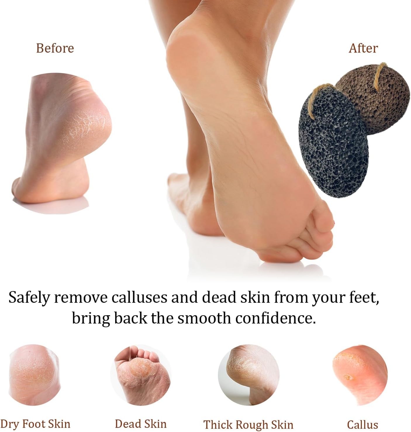 Pumice Stones for Feet - Natural Black Brown Earth Lava Stones Pack of 2 - Callus Corn Remover for Feet Heels and Palm - Pedicure Exfoliation Tool - Dry Dead Skin Scrubber - Health Foot Care
