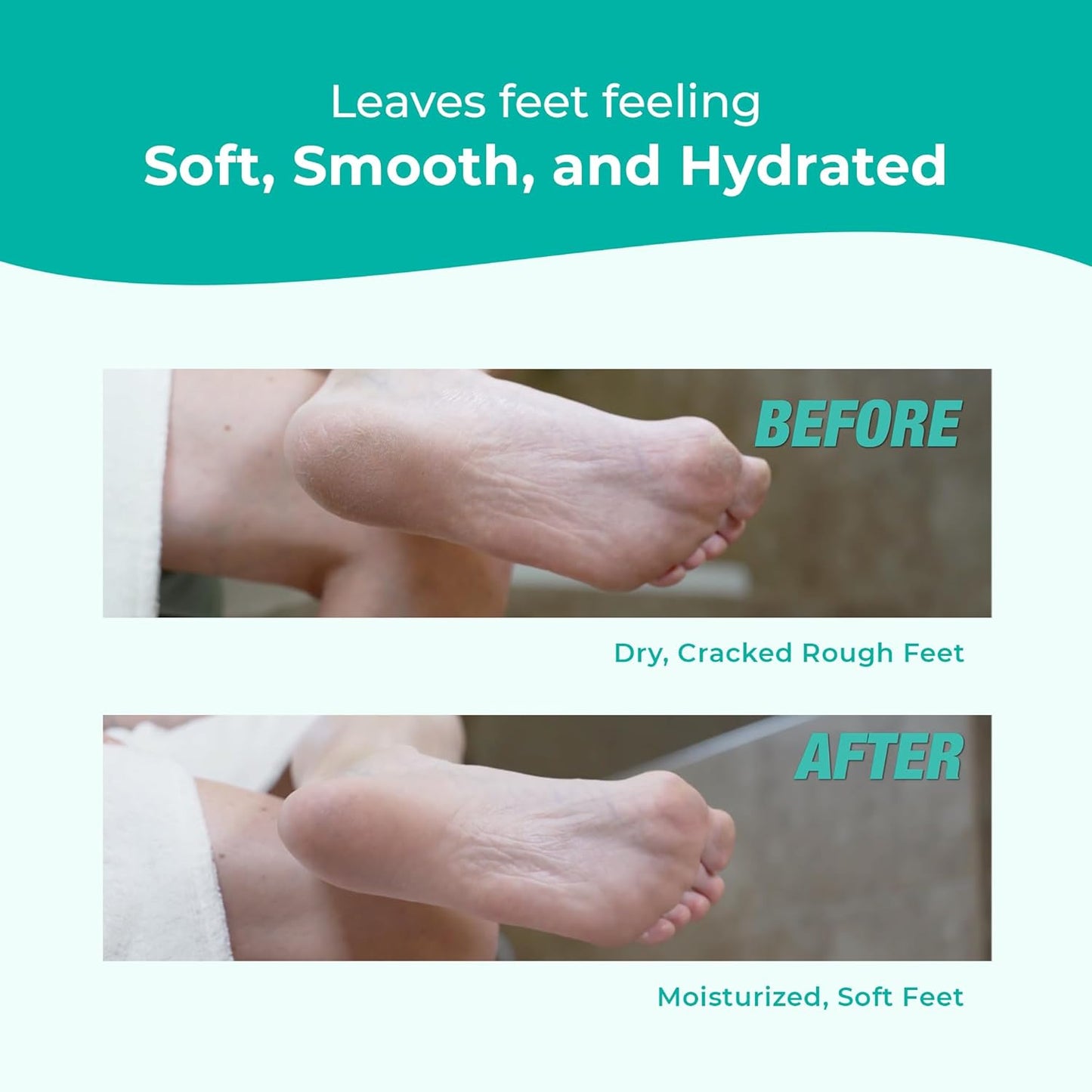 EZ Foot Care Cream - Advanced Exfoliating Urea Foot Cream for Dry Cracked Heels and Feet | 14 Natural Ingredients | Repairs, Hydrates and Smoothens Dry Cracked Feet - 100ml /3.38 fl. oz