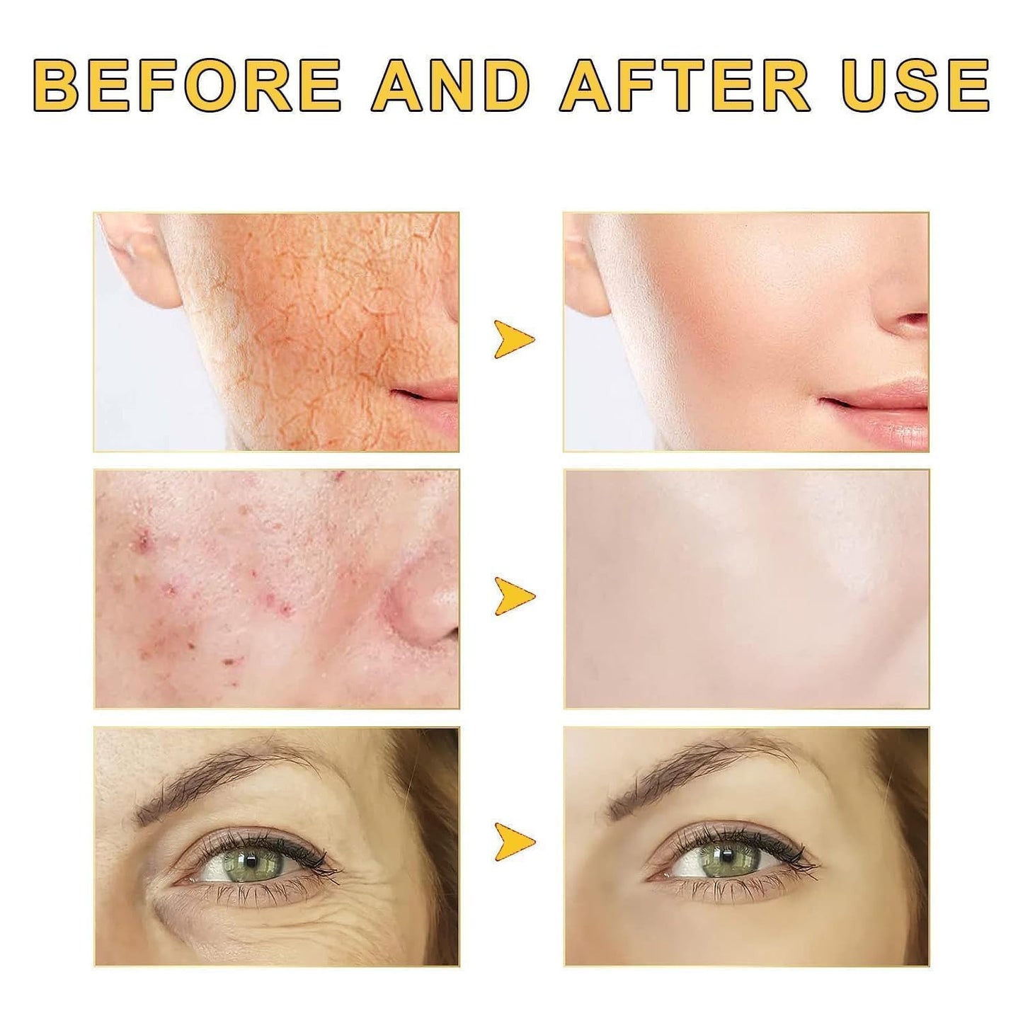 2PCS Advanced Snail Mucin 96% Power Repairing Essence, Snail Mucin 96% - Anti-Aging Serum, With Snail Secretion Filtrate For Dull (02)