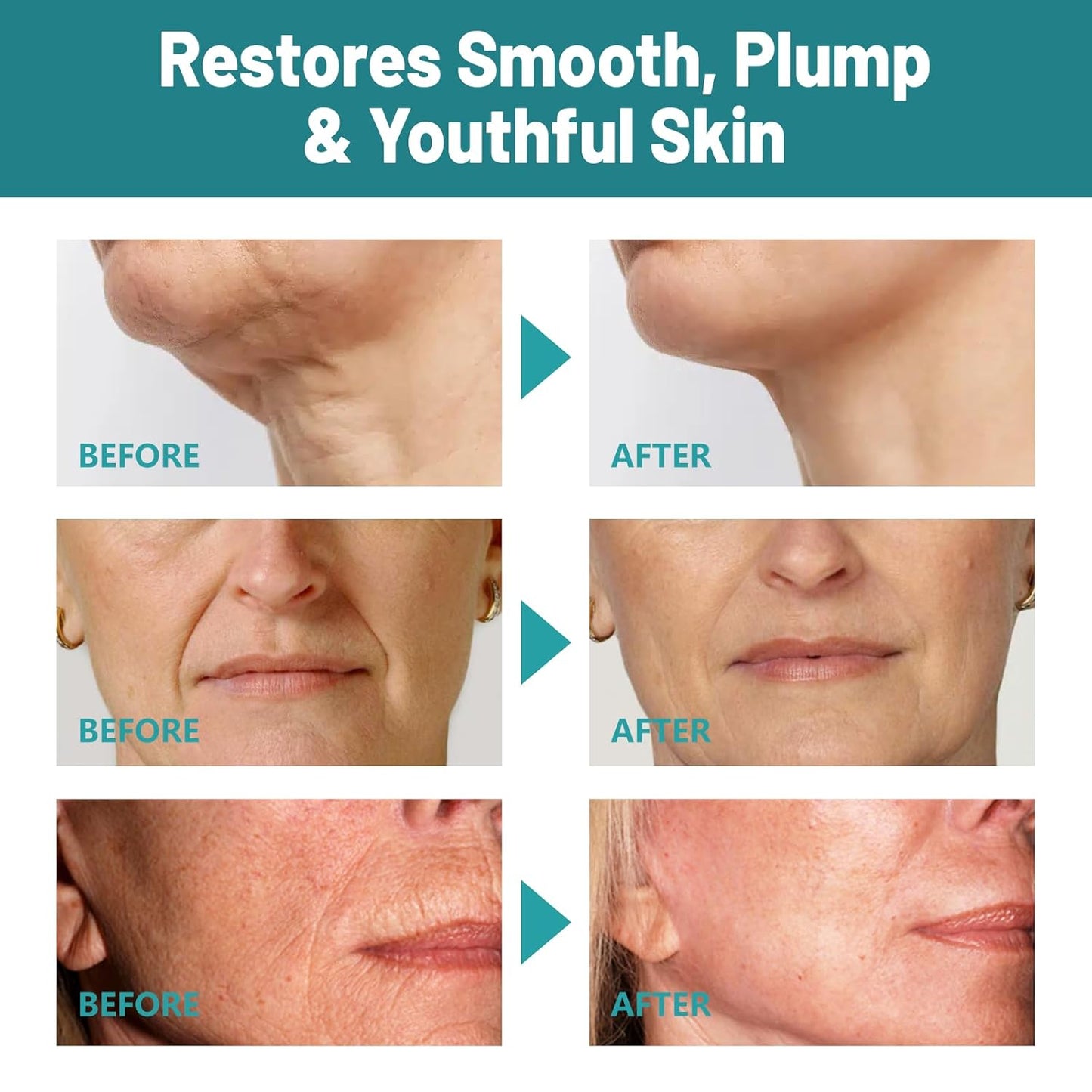 Crepes skin cream for aging skin ，Crepes Skin Repair Treatment, Firming Cream with Hyaluronic Acid & Shea Butter to Deeply Moisturize & Tighten Wrinkly Dry