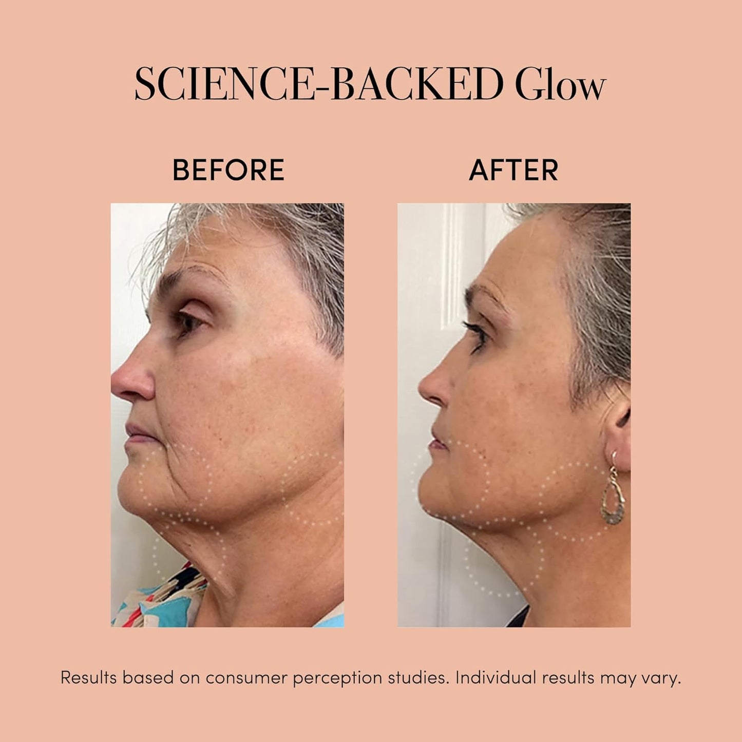 reVive Lux Collection Glo Aging & Acne Device, FDA-Cleared & Medspa-Quality Blue Light, Red, Amber & Infrared Acne Tools, Science-Backed LED Light Therapy Products