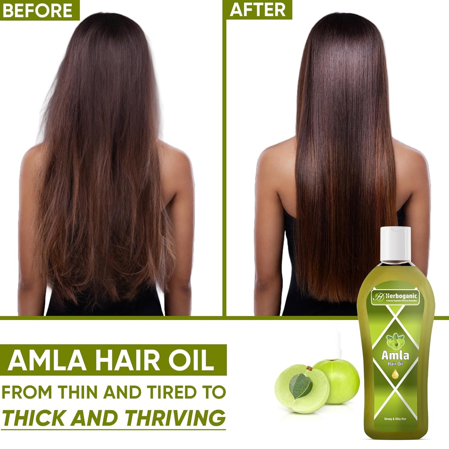 Amla Herbal Hair Oil, Stimulated Hair Growth, Reducing Hair Loss, Improve Scalp Circulation by Herboganic 5 Fl. Oz…