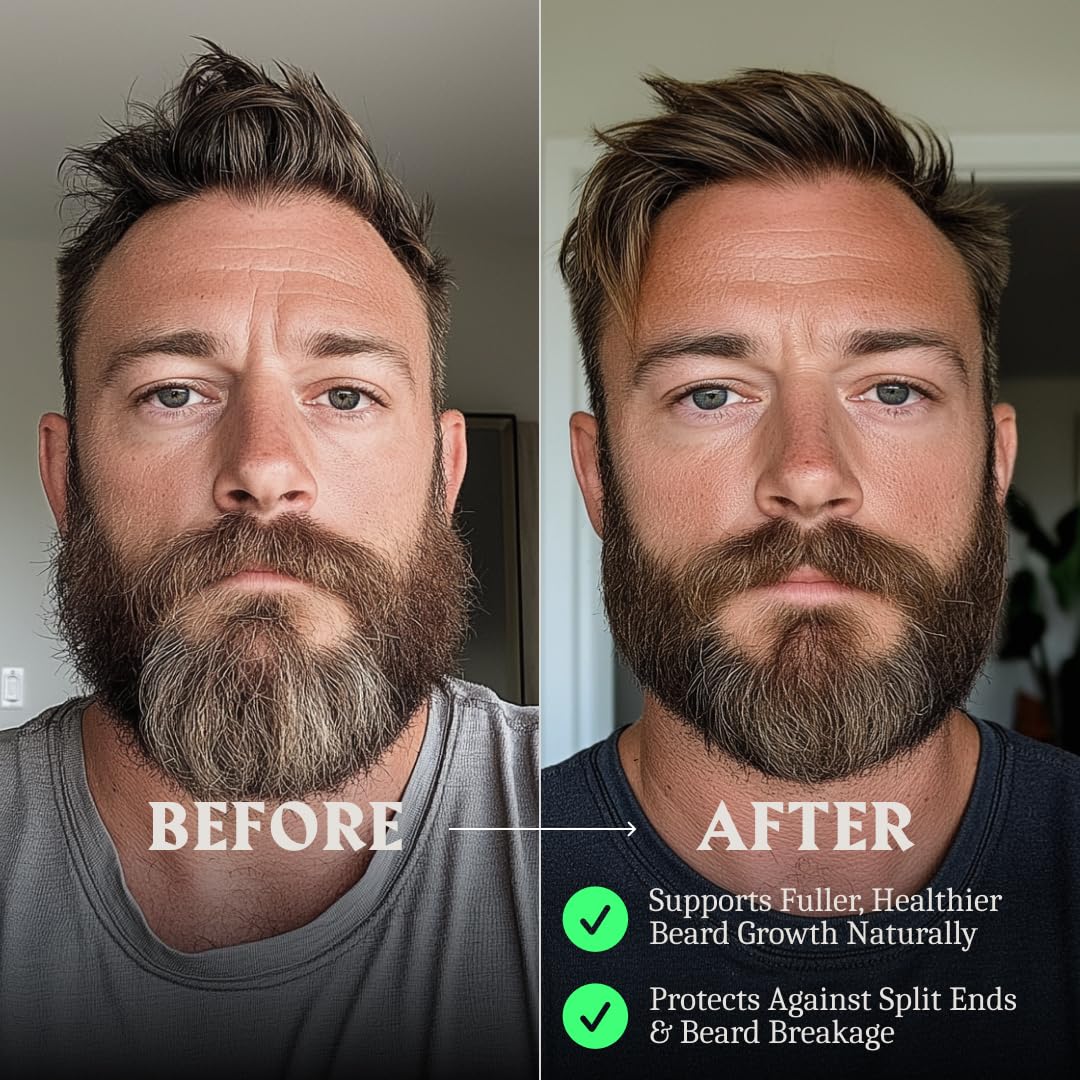 Striking Viking Beard Balm & Beard Oil for Men – Unscented, 1 Fl Oz Each - Dual-Use Leave In Conditioner - Tames, Styles & Moisturizes – With Naturally-Derived Argan & Jojoba Oil