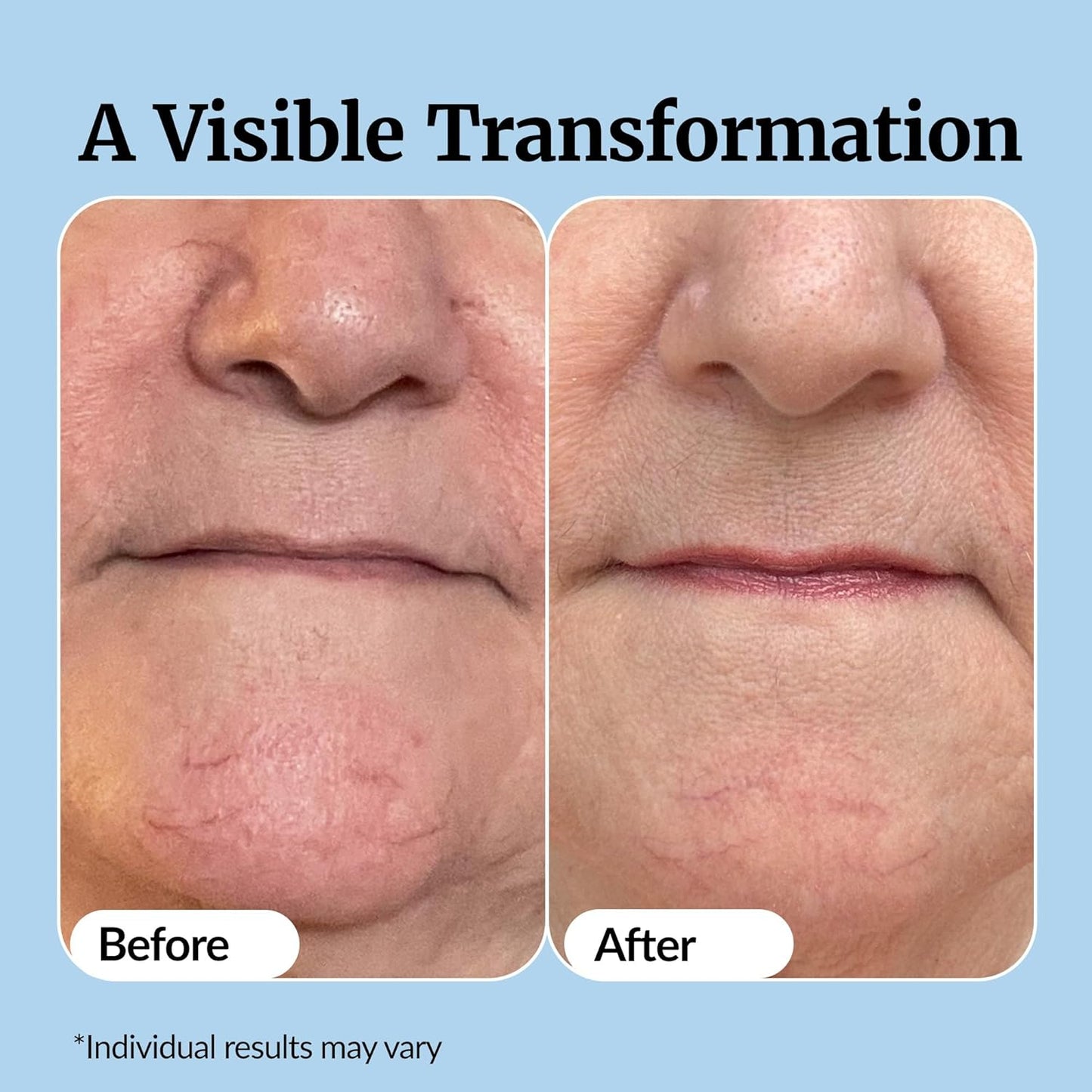 Vibriance Super C Serum for Mature Skin - All-in-One Vitamin Formula Hydrates, Firms, Lifts, Smooths, Targets Age Spots, Wrinkles, 1 fl oz - Pack of 2