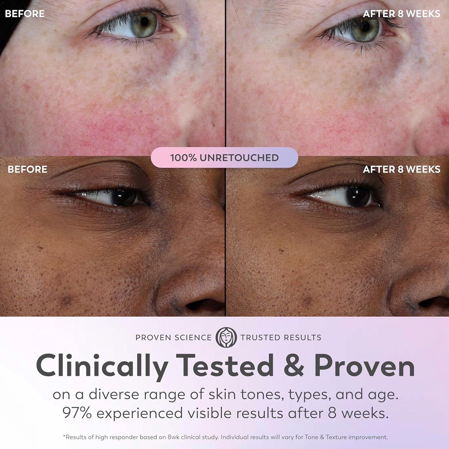 Olay Super Serum - Niacinamide, Vitamin C & E, Collagen Peptide, AHA - 5-in-1 Skin Care Benefits for Face - Healthy Glow, Brightening, Hydrating, Smoothing, Firming, Evens Tone, Anti-Aging, 1.0 Oz