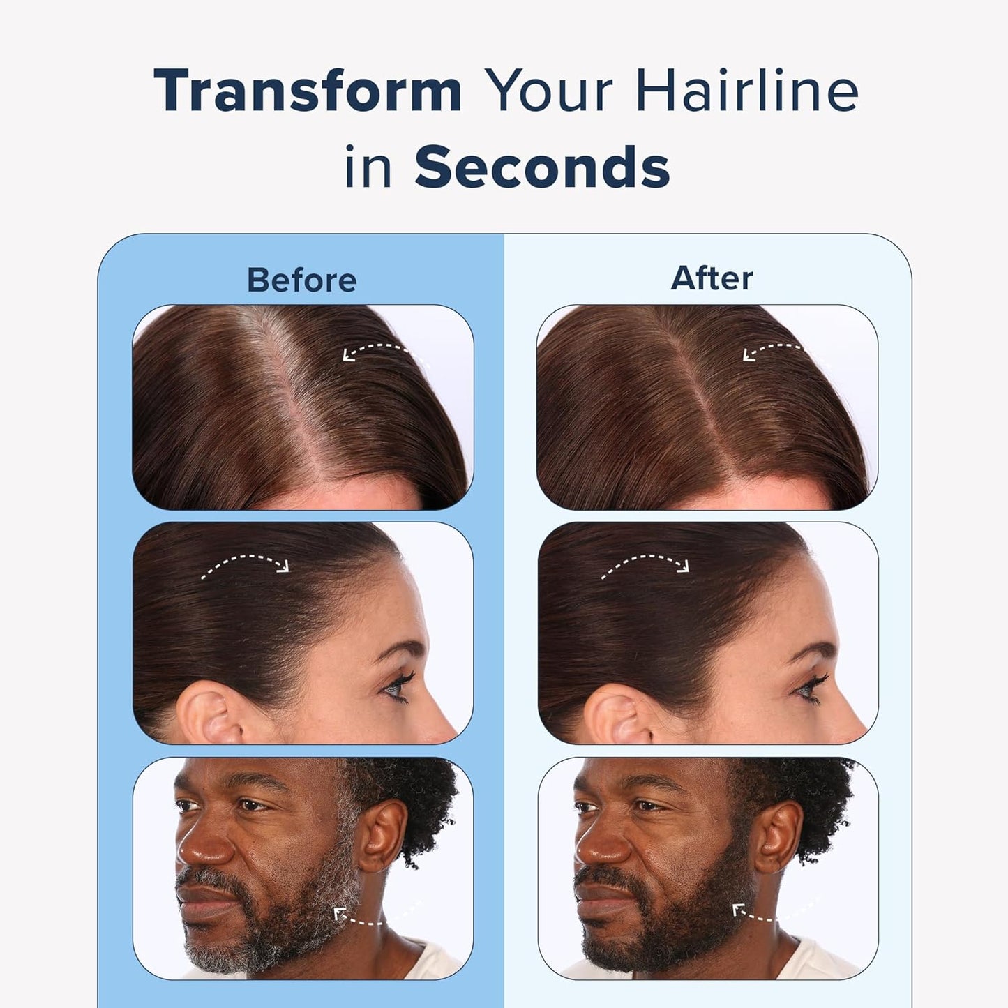 TRUHAIR Color & Conceal Waterproof Root Touch Up Hair Color Concealer - Hair Cover up for Gray Coverage and Hairline Filling - 11 Hair Colors Available (Light Brown)