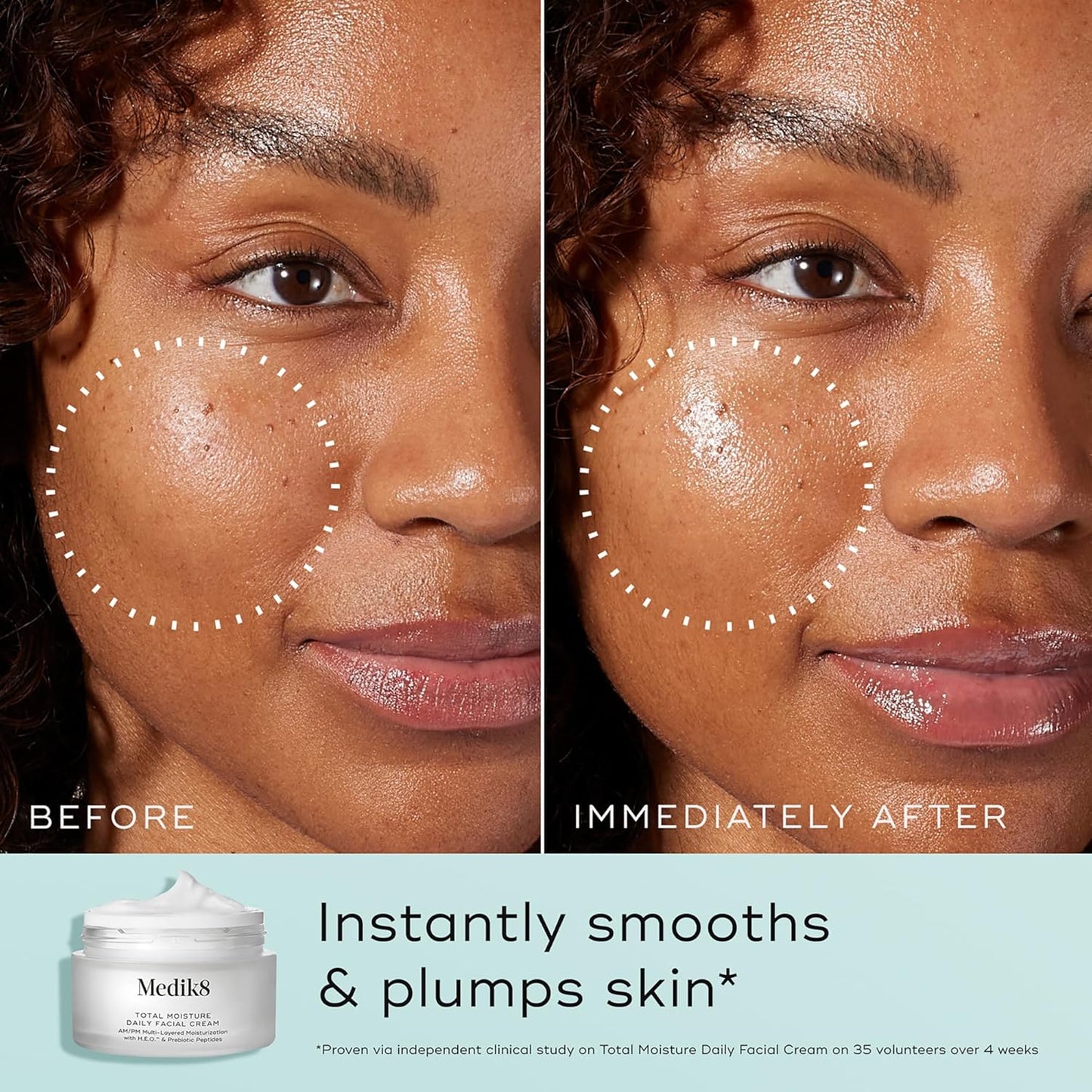 Medik8 Total Moisture Daily Facial Cream - Hydrating Peptide Face Moisturizer with Hyaluronic Acid - Face Cream Supports Skin Barrier - 1.6 oz