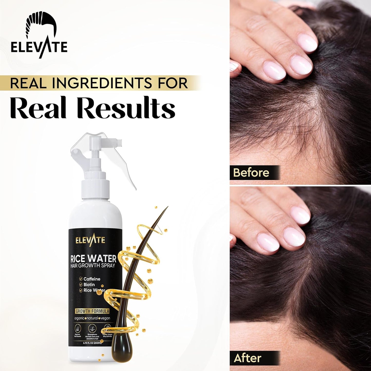 Elevate Rice Water Hair Growth Spray - Infused with Biotin, Caffeine & Aloe Vera for Thicker, Longer, Softer Hair - Fermented Leave In Mist for Thinning, Damaged Hair - Vegan & Non-Greasy