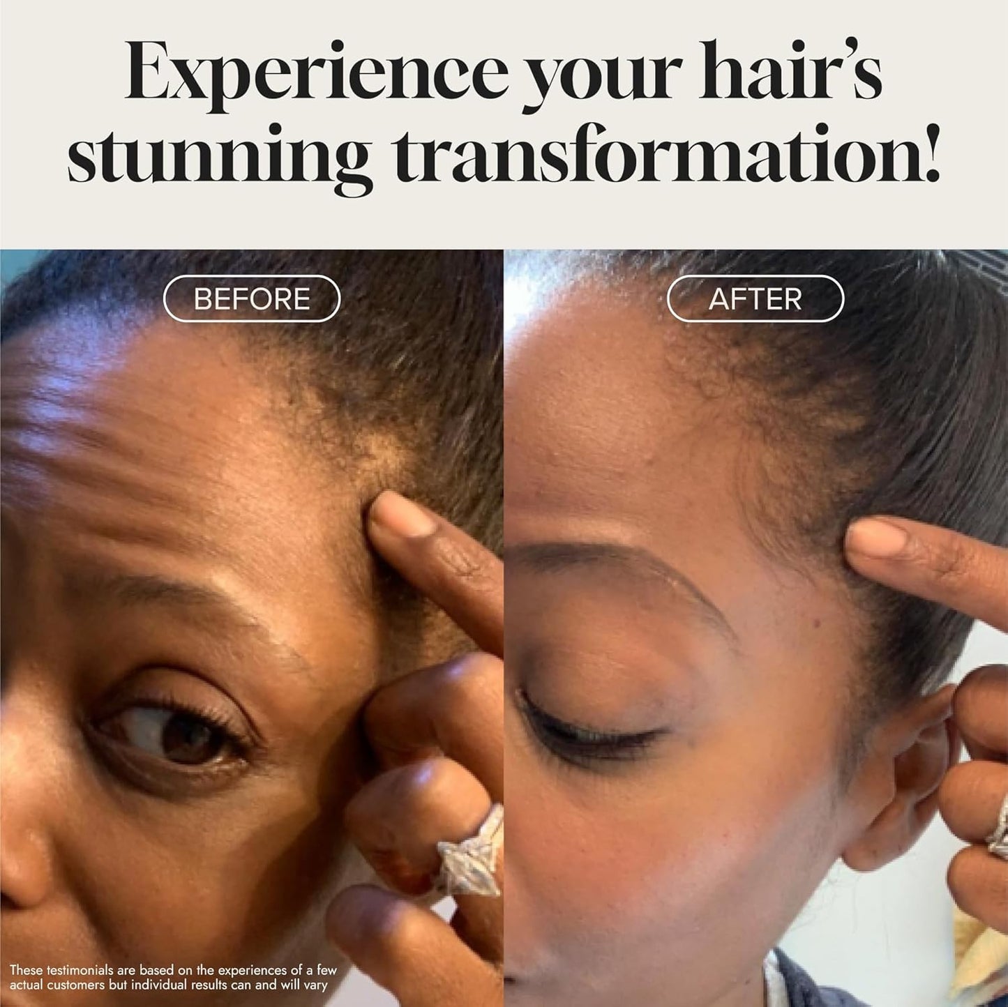 Biotin Hair Growth Serum Advanced Topical Formula To Help Grow Healthy, Strong Hair Suitable for Men and Women of All Hair Types Hair Loss Support By Pureauty Naturals 2 Fl Oz (Pack of 1)