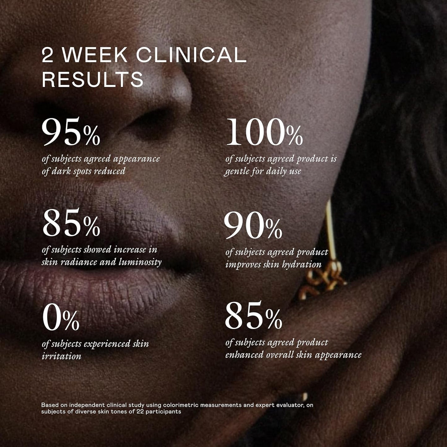 EADEM Milk Marvel Dark Spot Serum, Vitamin C Face Serum Infused with Niacinamide, Dark Spot Remover for Face and Body, Natural Dark Spot Corrector for Skin Care, 1 oz