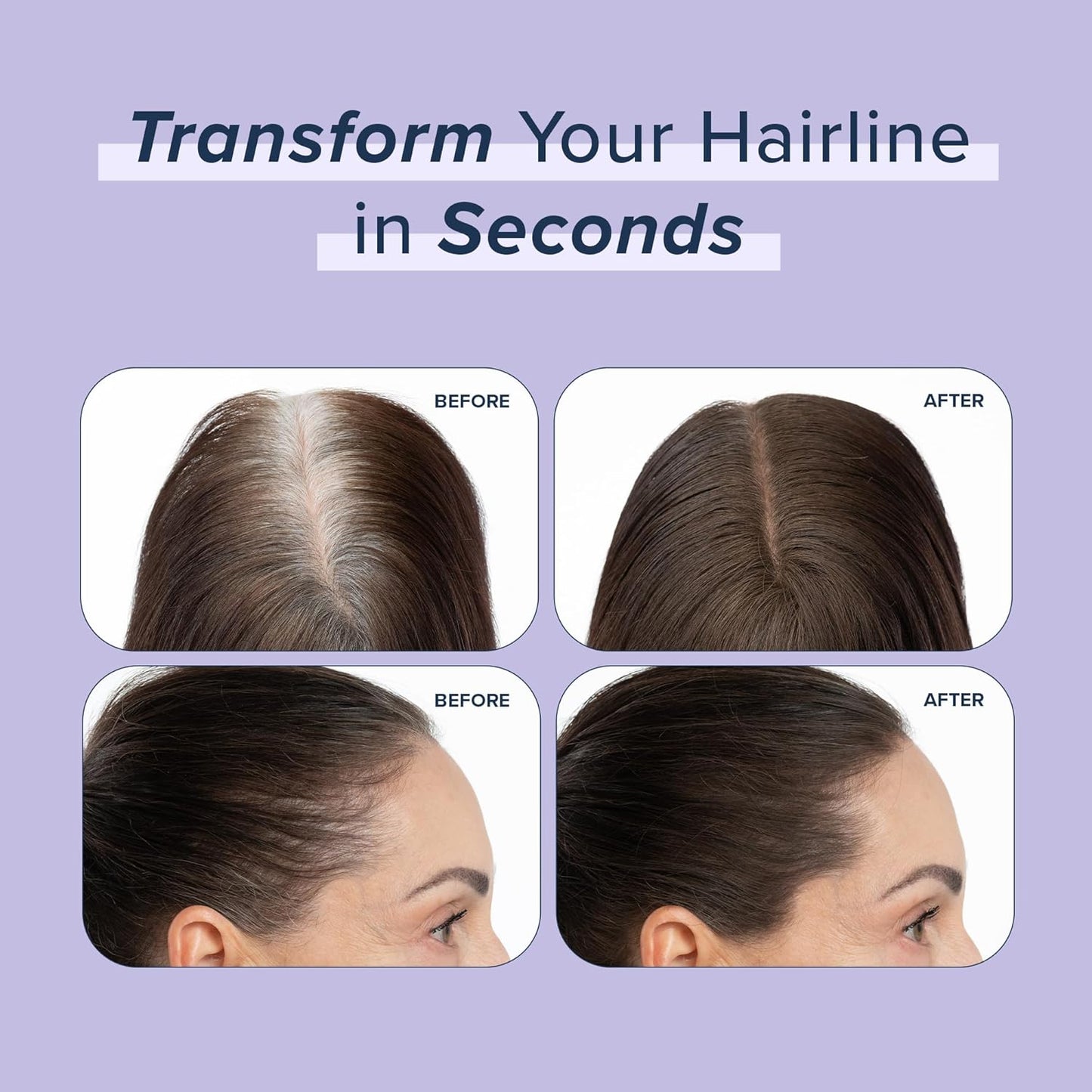 TRUHAIR Root & Scalp Cover Up Pressed Powder Compact, Waterproof, Weightless Hair Coverage & Bald Spot Concealing, Root Touch Up Hair Color for Gray Coverage & Thinning Areas, 0.35 Oz (Darkest Brown)