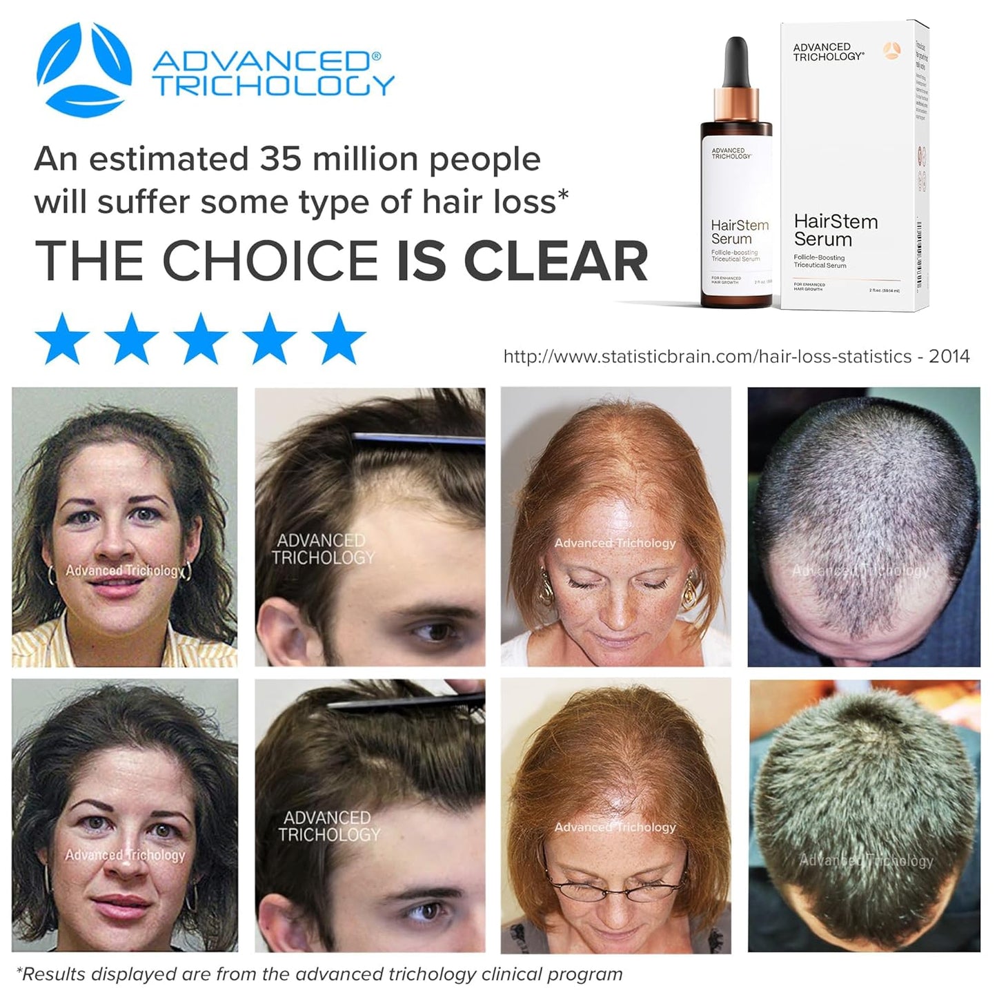 HairStem Follicle-boosting Triceutical Serum for Thicker Fuller Hair | Triple-Action, Multi-Zonal Topical Serum for Hormonal, Nutritional, and Inflammatory-Related Hair