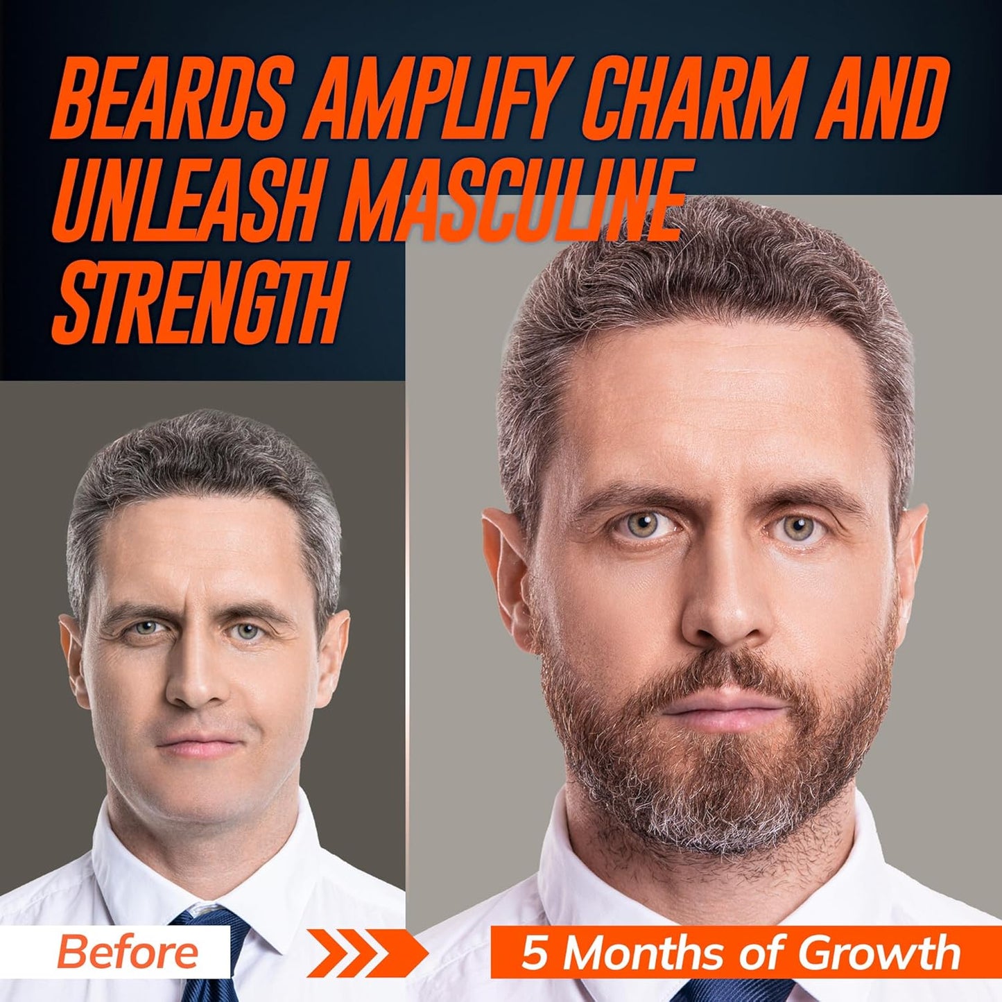 5% Minoxidil Beard Growth Serum for Men: Hair Regrowth Spray with Biotin & Rice Water - Extra Strength Beard Oil for Faster Thicker and Fuller Beard Growth - 60ML