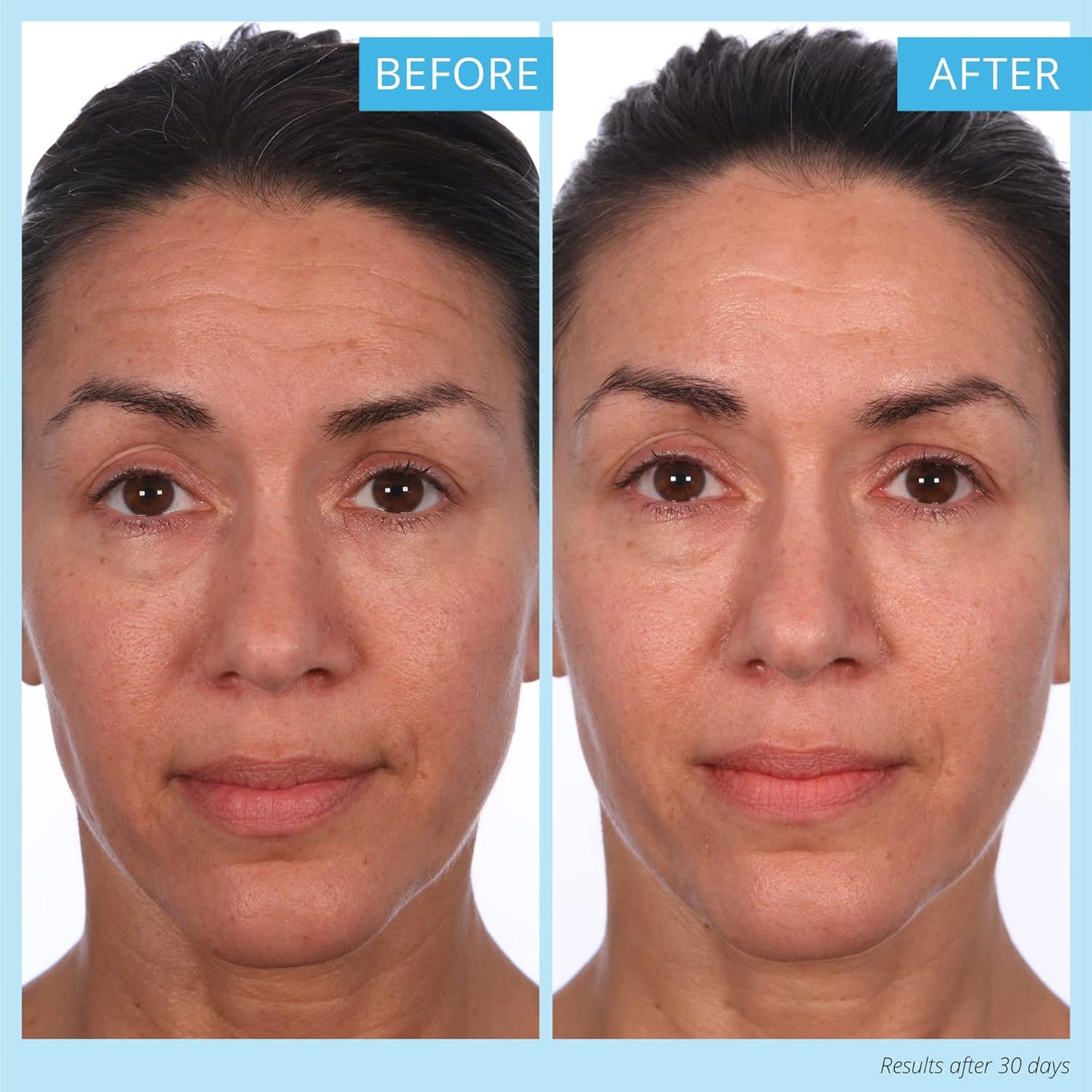 SKINN Crème Reverse with Ferulic Acid, Retinol and Vitamin C-Crème Reverse Intensive-Anti-Aging Cream with Hyaluronic Acid to Plump Skin Vitamin C Help to Improving Tone, Firmness of Skin