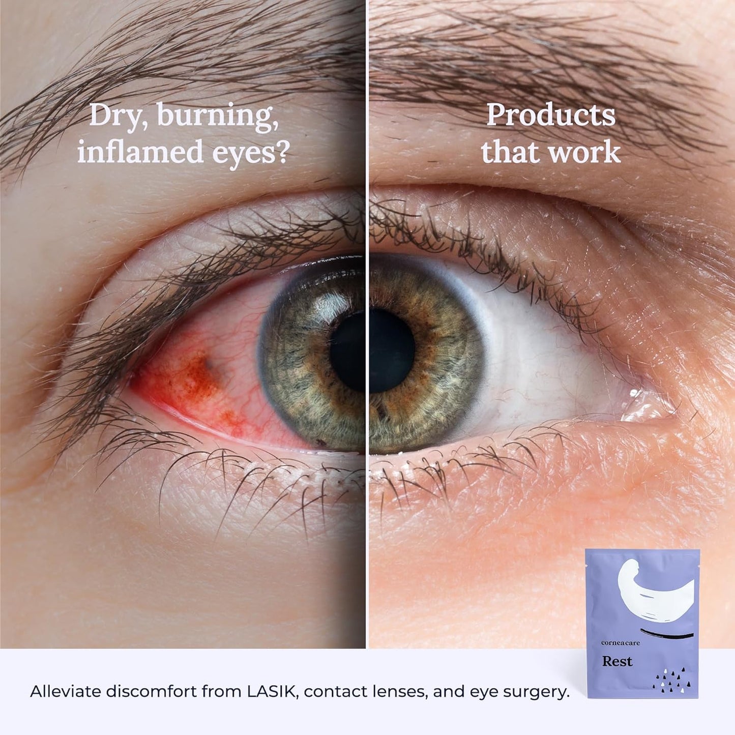 Rest: Self heating warm compress for dry eye | Heated eye Mask for fast relief | No microwave or washcloths needed | Travel ready | 90 counts